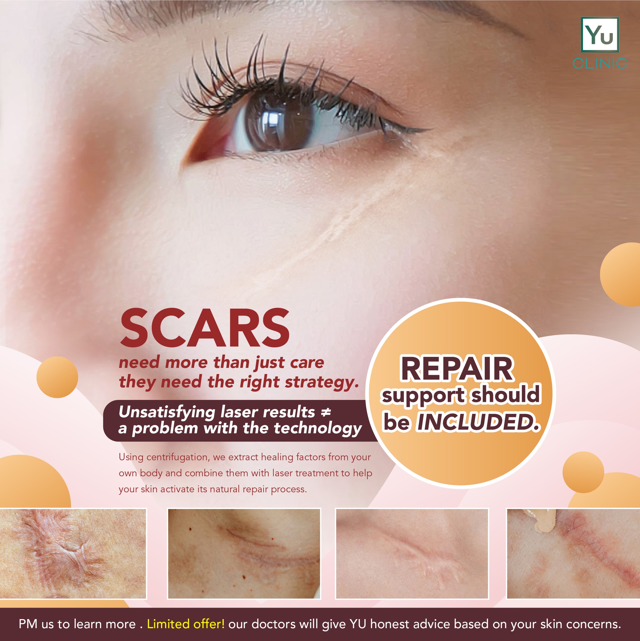 Yu Clinic Facebook ad