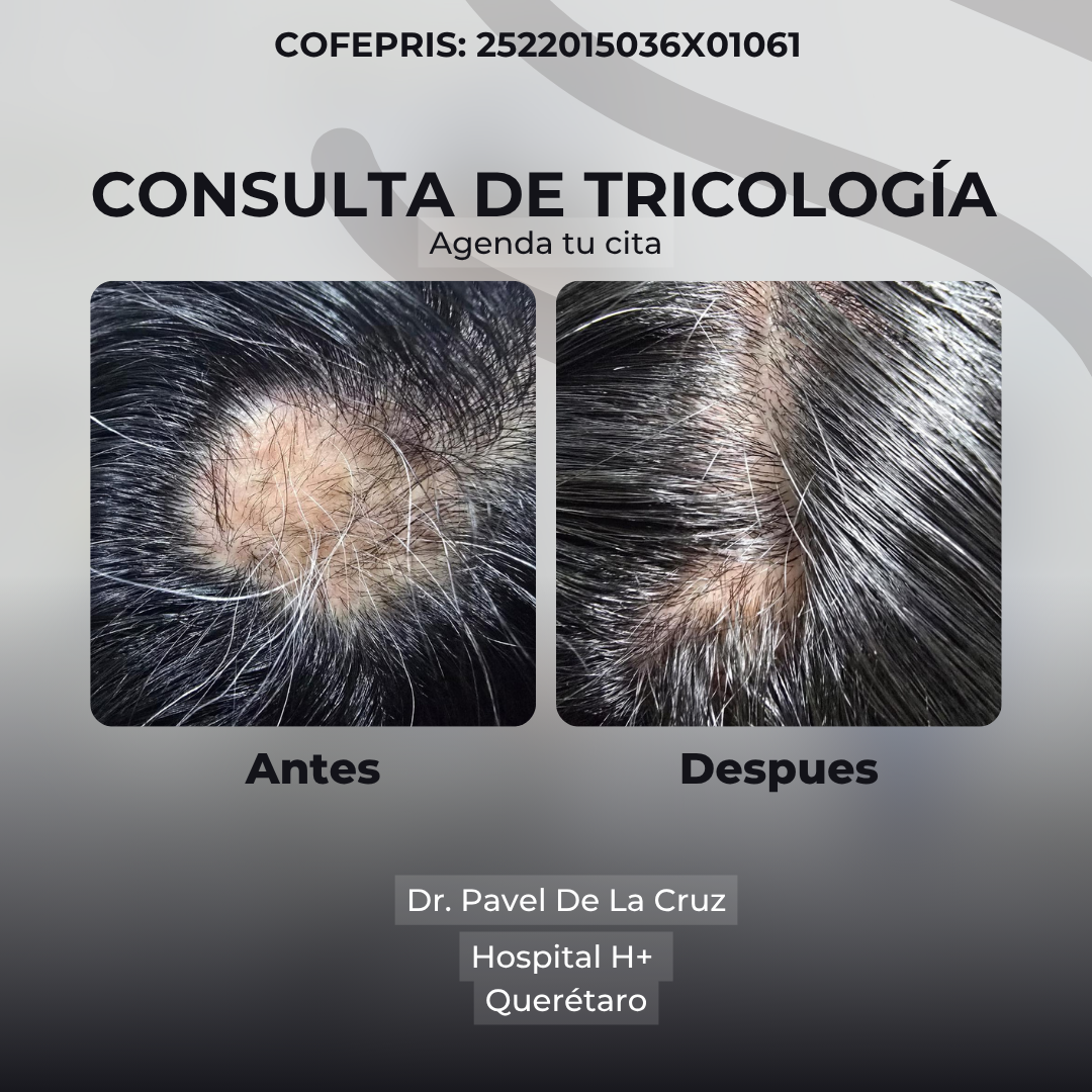 Clínica de tricología e hiperhidrosis Facebook ad