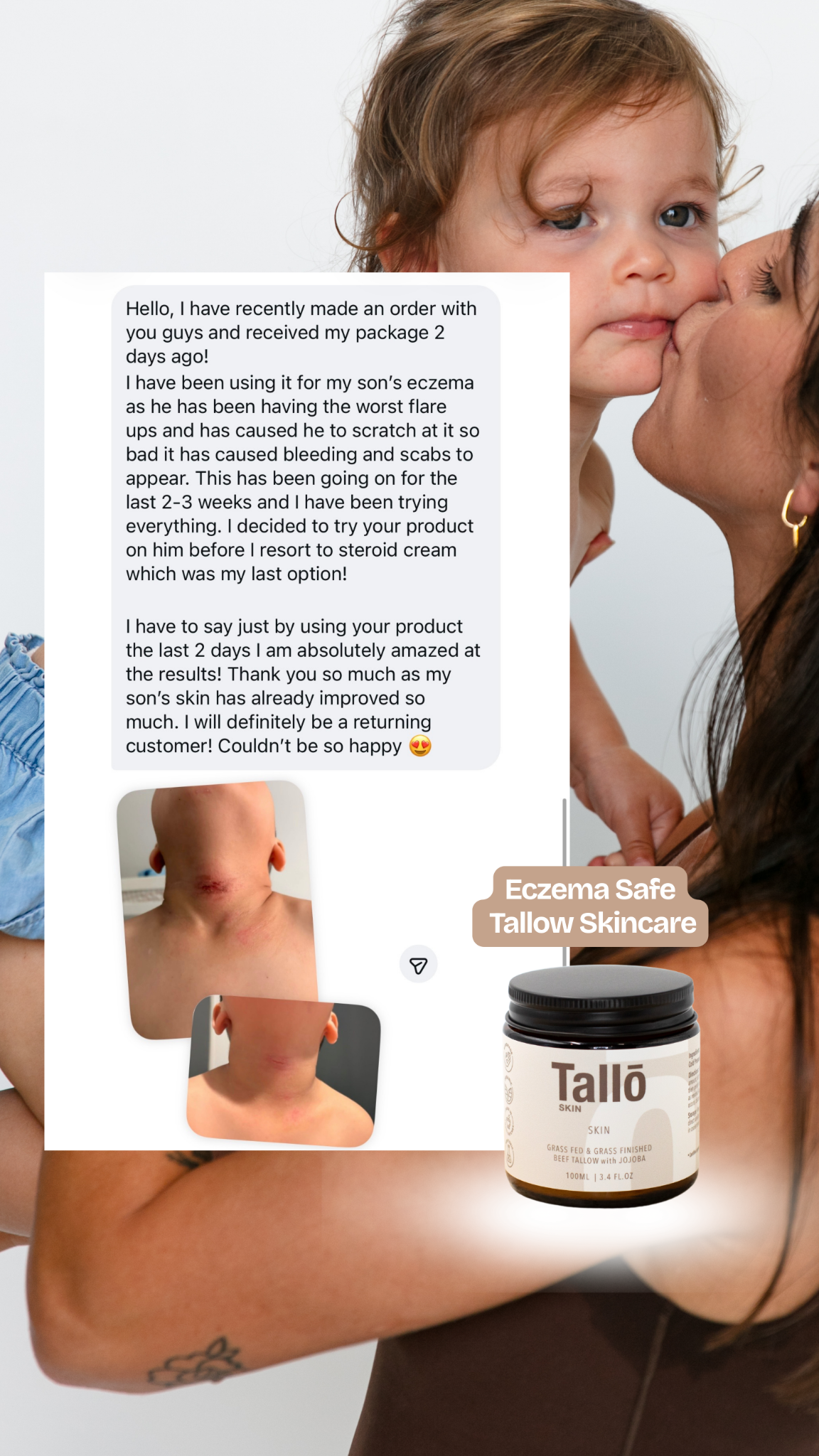 Tallo Skin Facebook ad