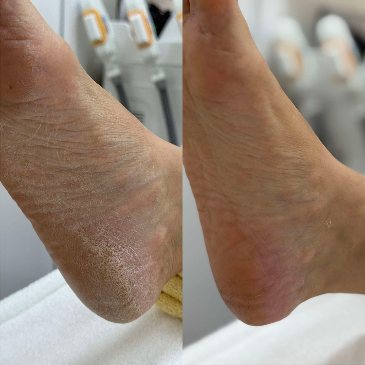Revolution Skin & Brow Clinic Facebook ad: MediPedi for soft, smooth feet