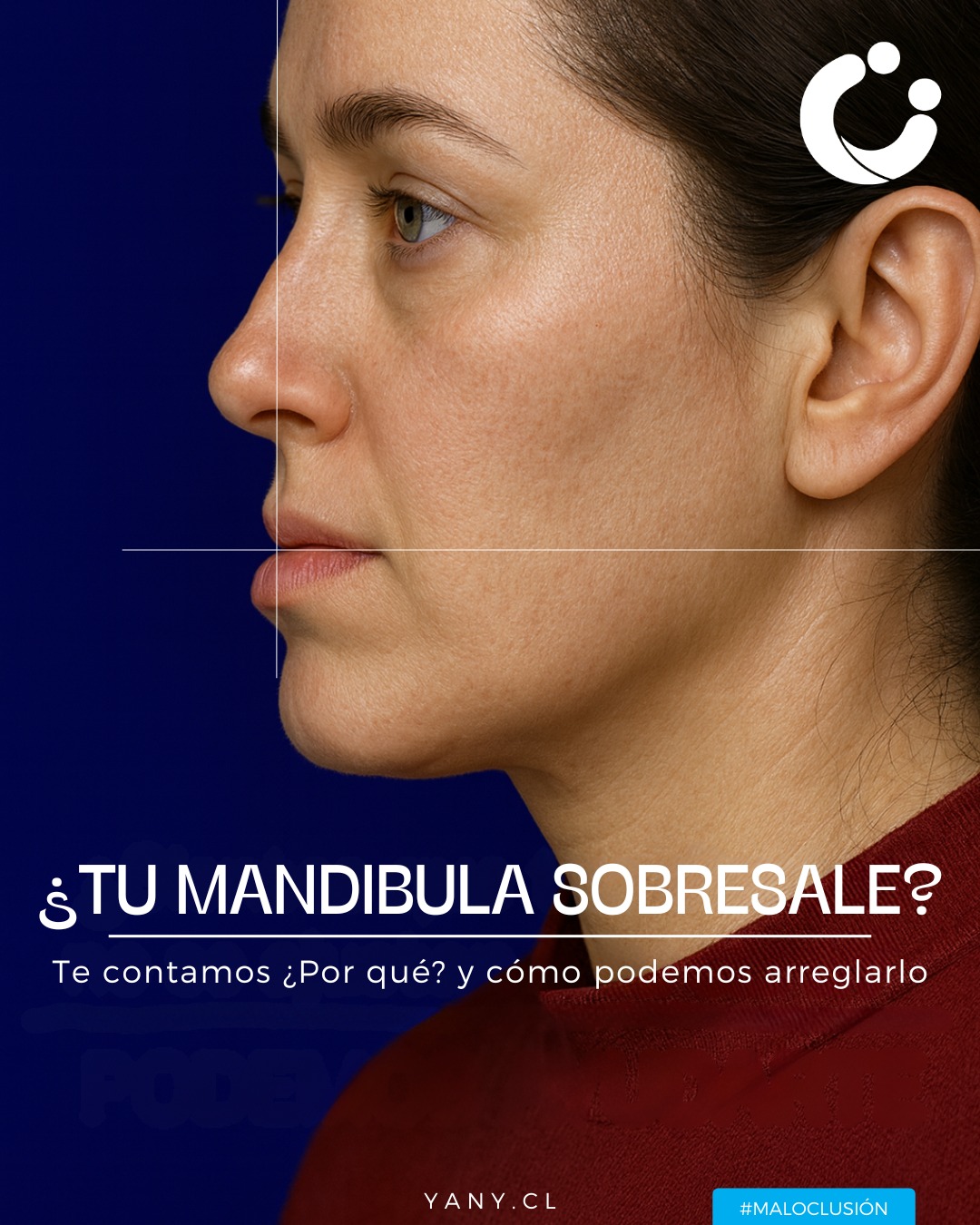 Clinica Dental Yany Facebook ad: ¿Tu mandíbula sobresale más de lo normal?
