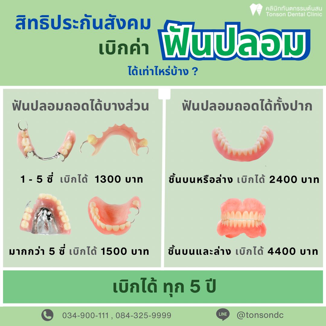 คลินิกทันตกรรมต้นสน - Tonson Dental Clinic จัดฟัน จัดฟันใส รากเทียม นครปฐม Facebook ad: สิทธิประกันสังคม สามารถใช้เบิกค่าฟันปลอมได้