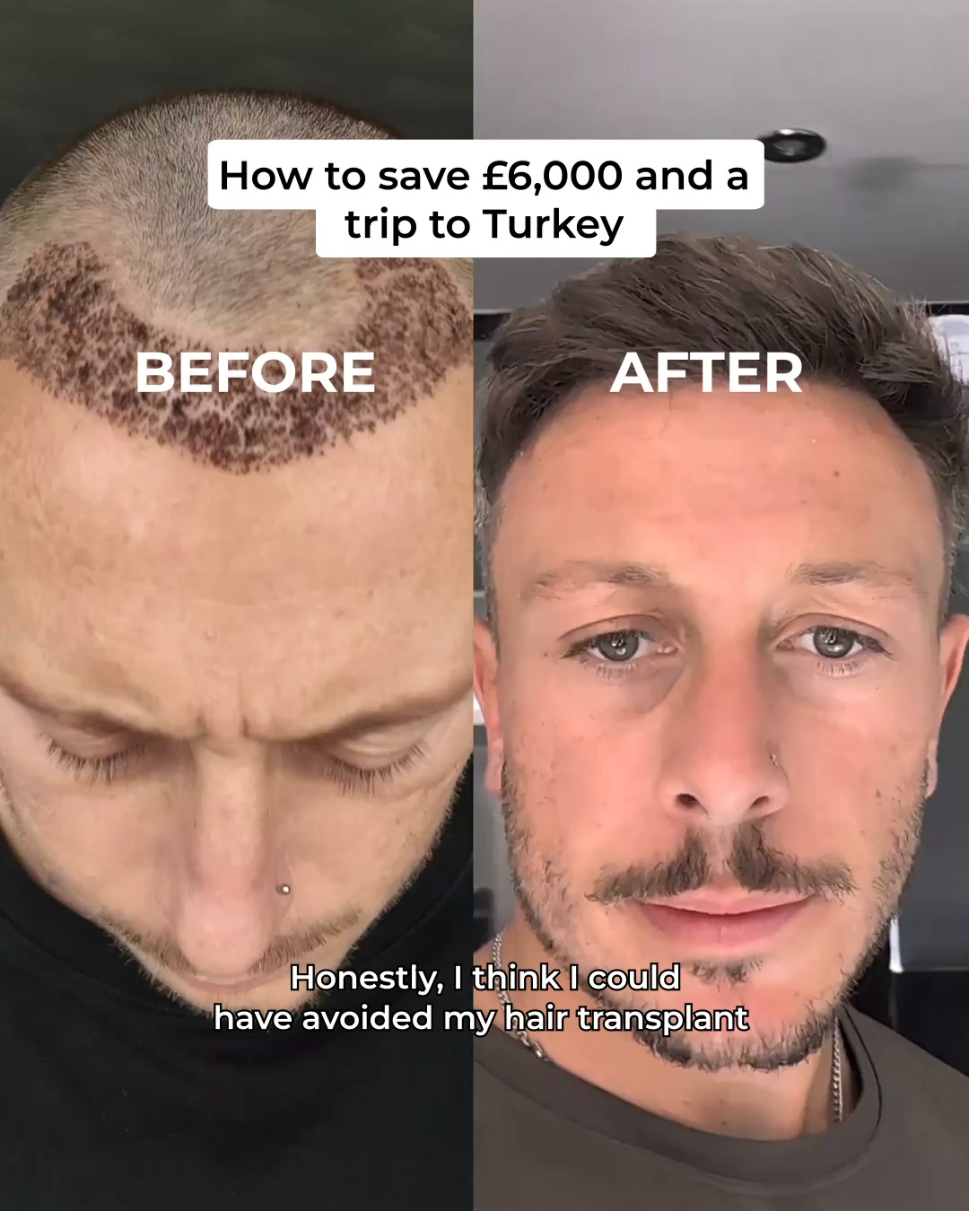 hims Facebook ad: Hair loss treatment, minus the hassle