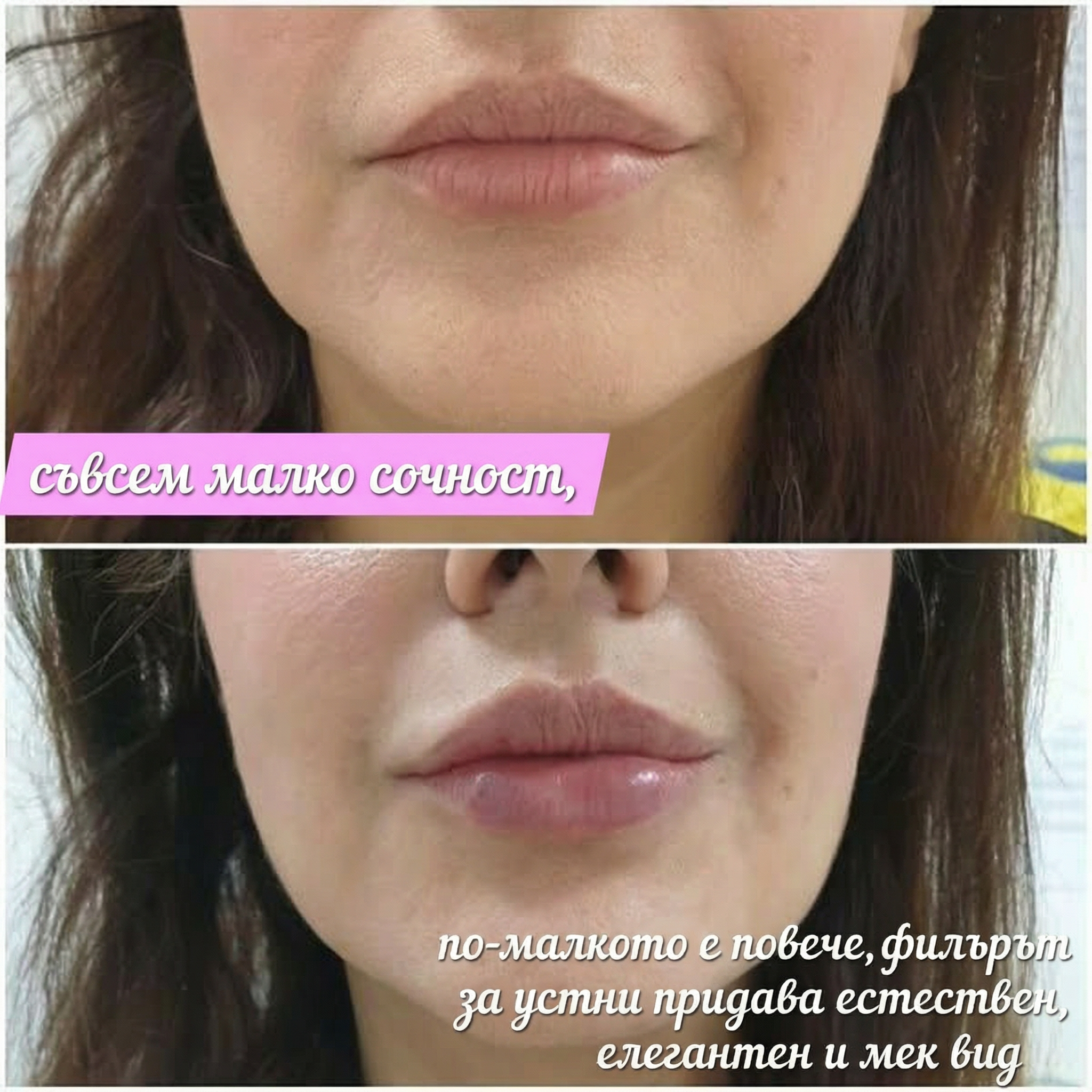 Vitalaiz Естетичен център Facebook ad