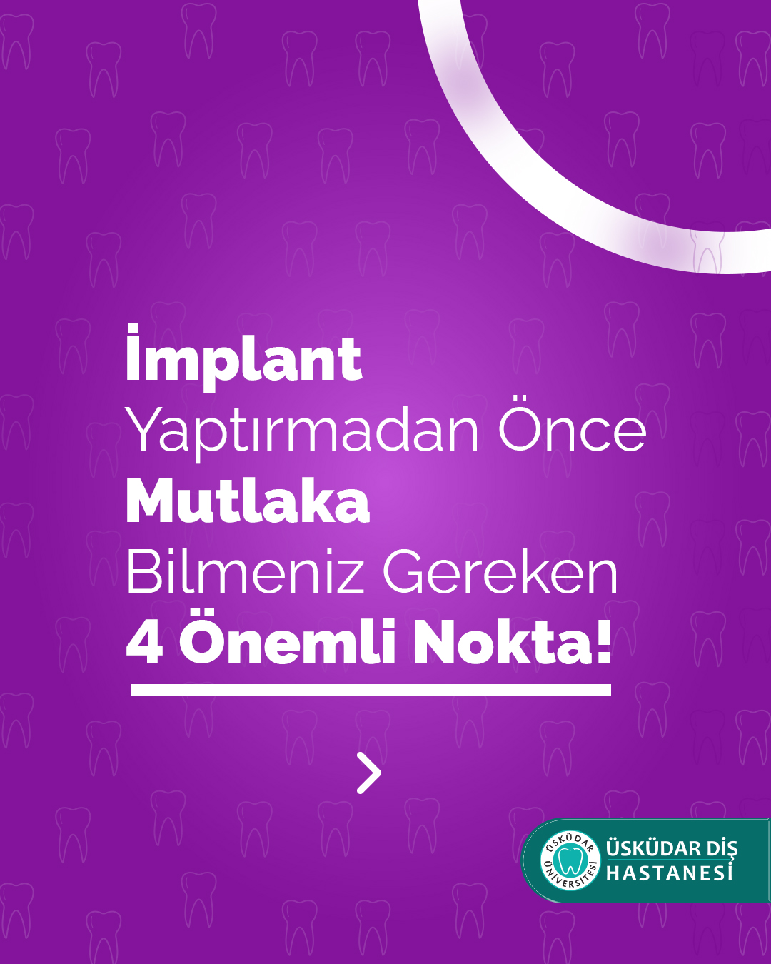 Üsküdar Üniversitesi Diş Hastanesi Facebook ad: İmplant Yaptırmadan Önce Nelere Dikkat Edilmeli?