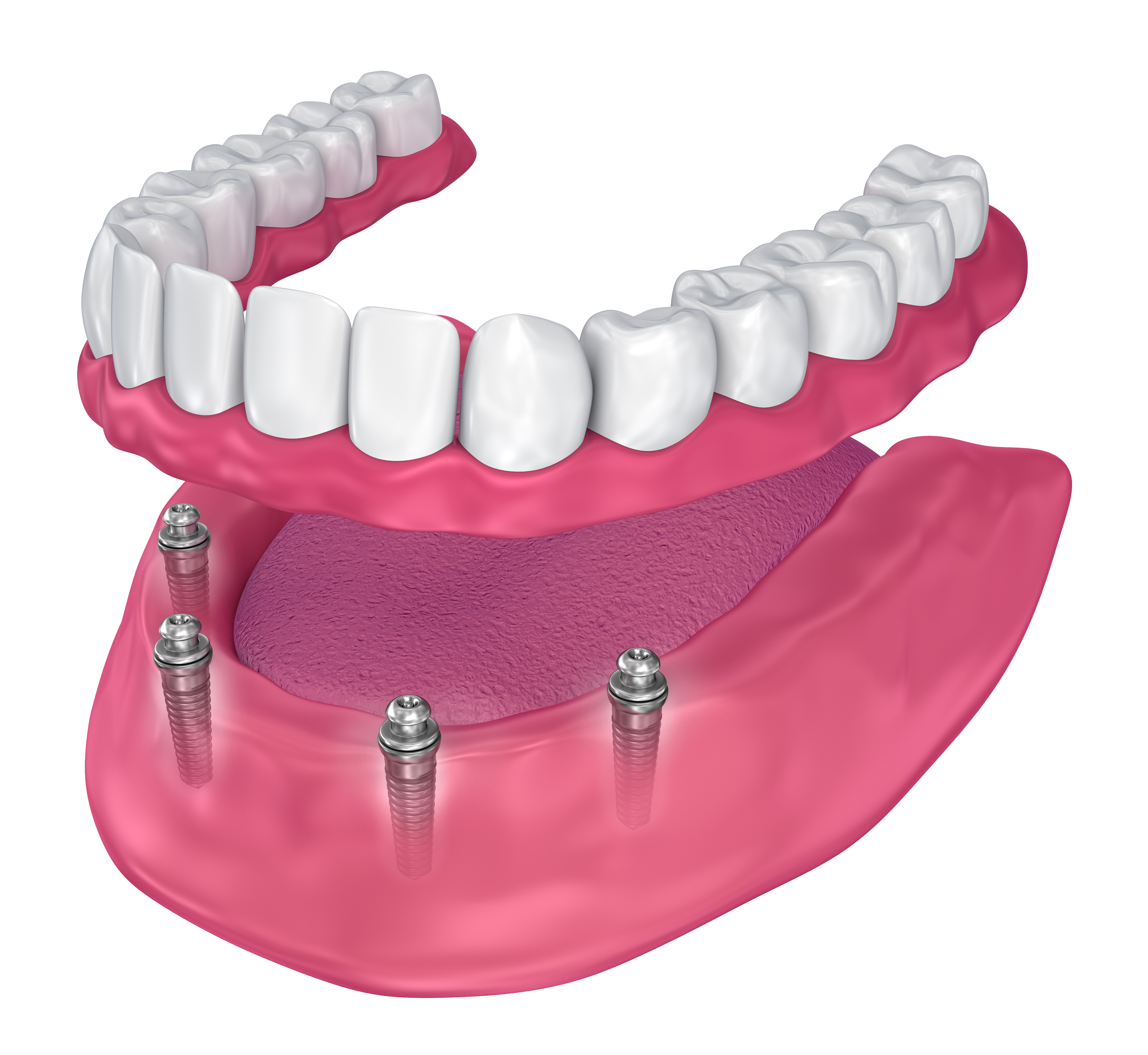 Village Dental-Claycomo & KC Dental ER Facebook ad