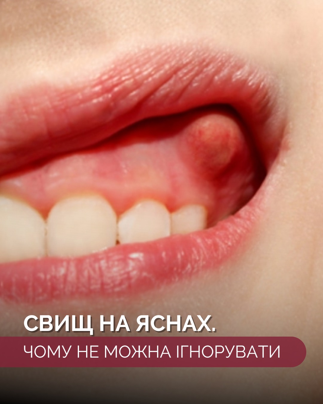Стоматология Vilida Киев Facebook ad: Стоматологія на Оболоні ᐉ Vilida - твоя персональна…