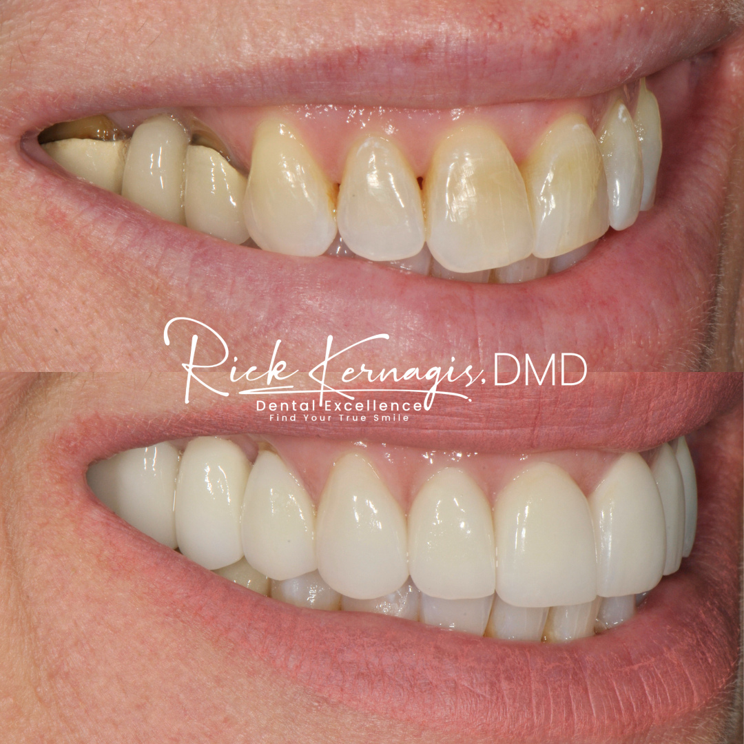 Rick Kernagis, DMD Facebook ad: Cosmetic Dentist | Dr. Richard Kernagis DMD - Tampa, FL