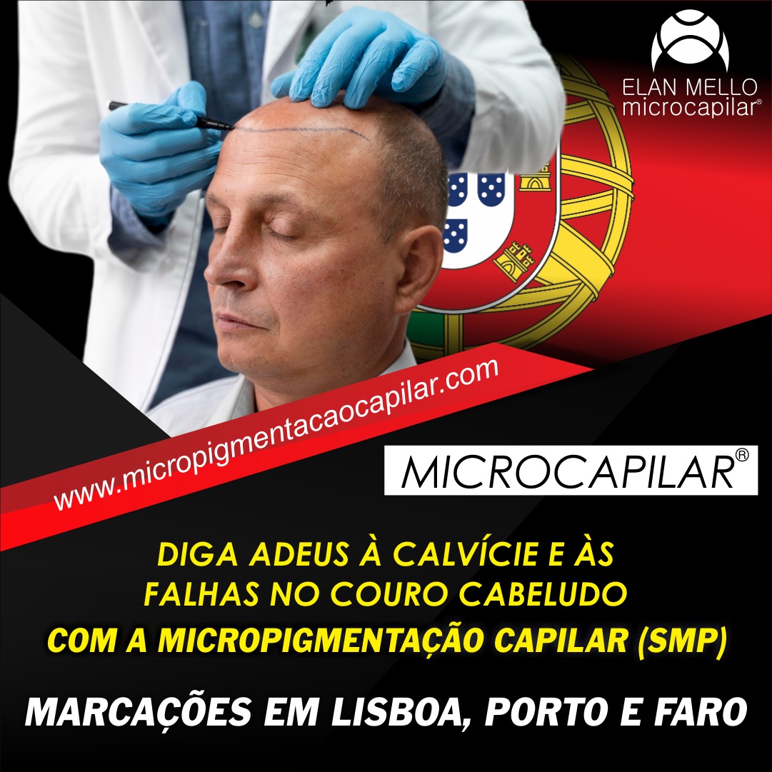 Vanessa Mello Art, By Elan Mello. Facebook ad: Realize a Microcapilar para tratar e restaurar calvície…