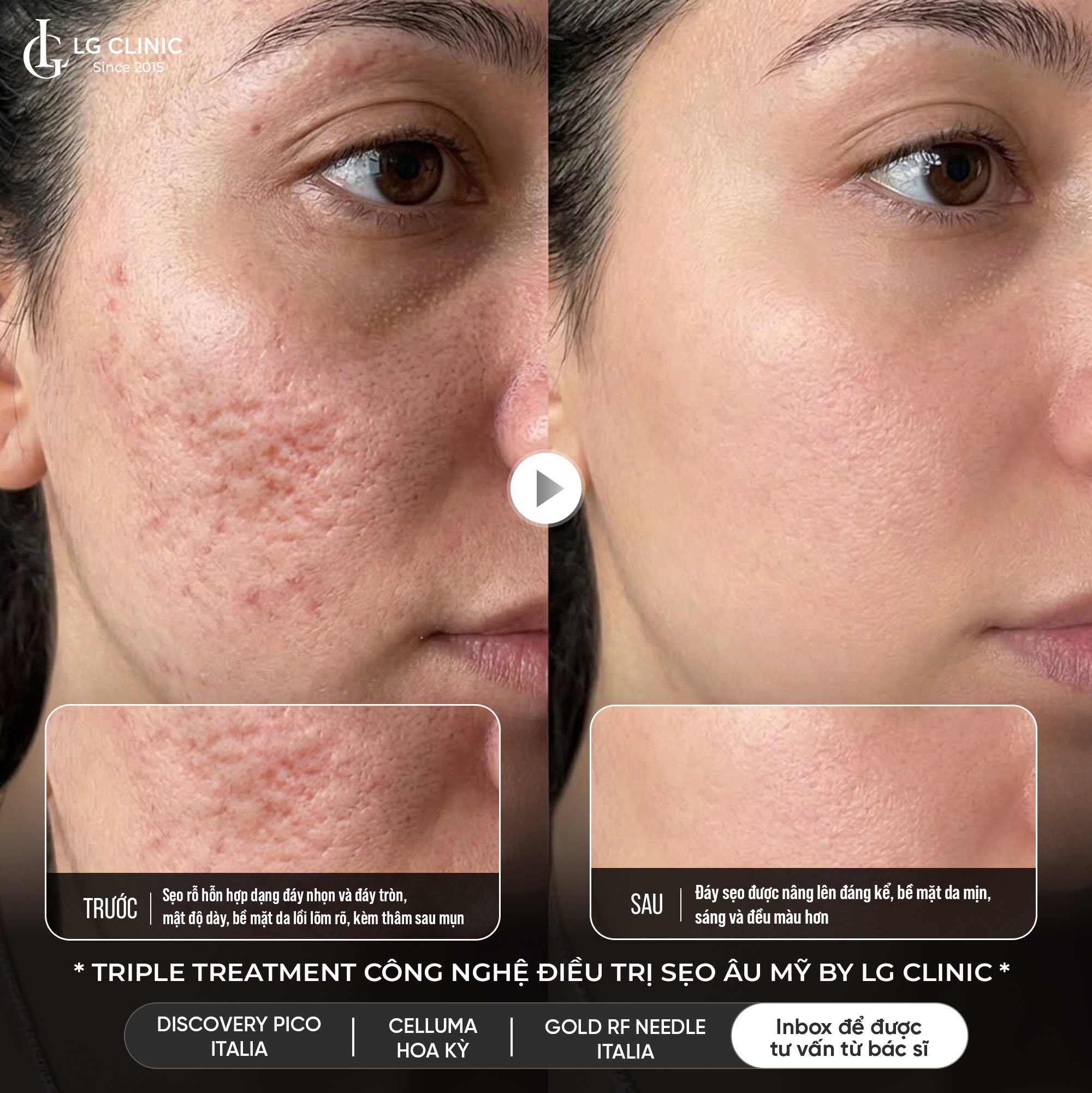 Viện Thẩm Mỹ LG Clinic Facebook ad