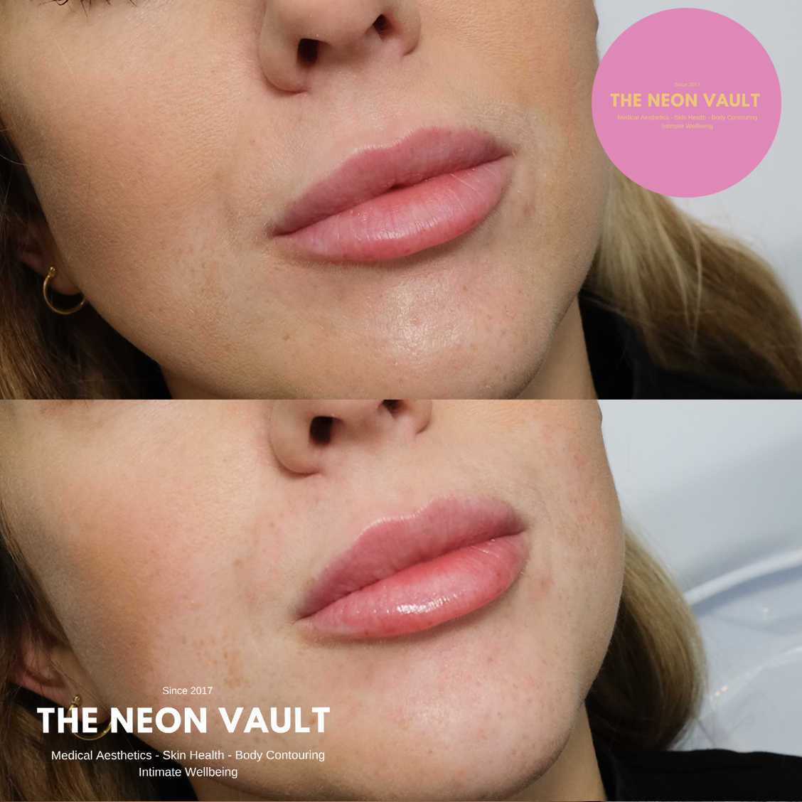 The Neon Vault Facebook ad