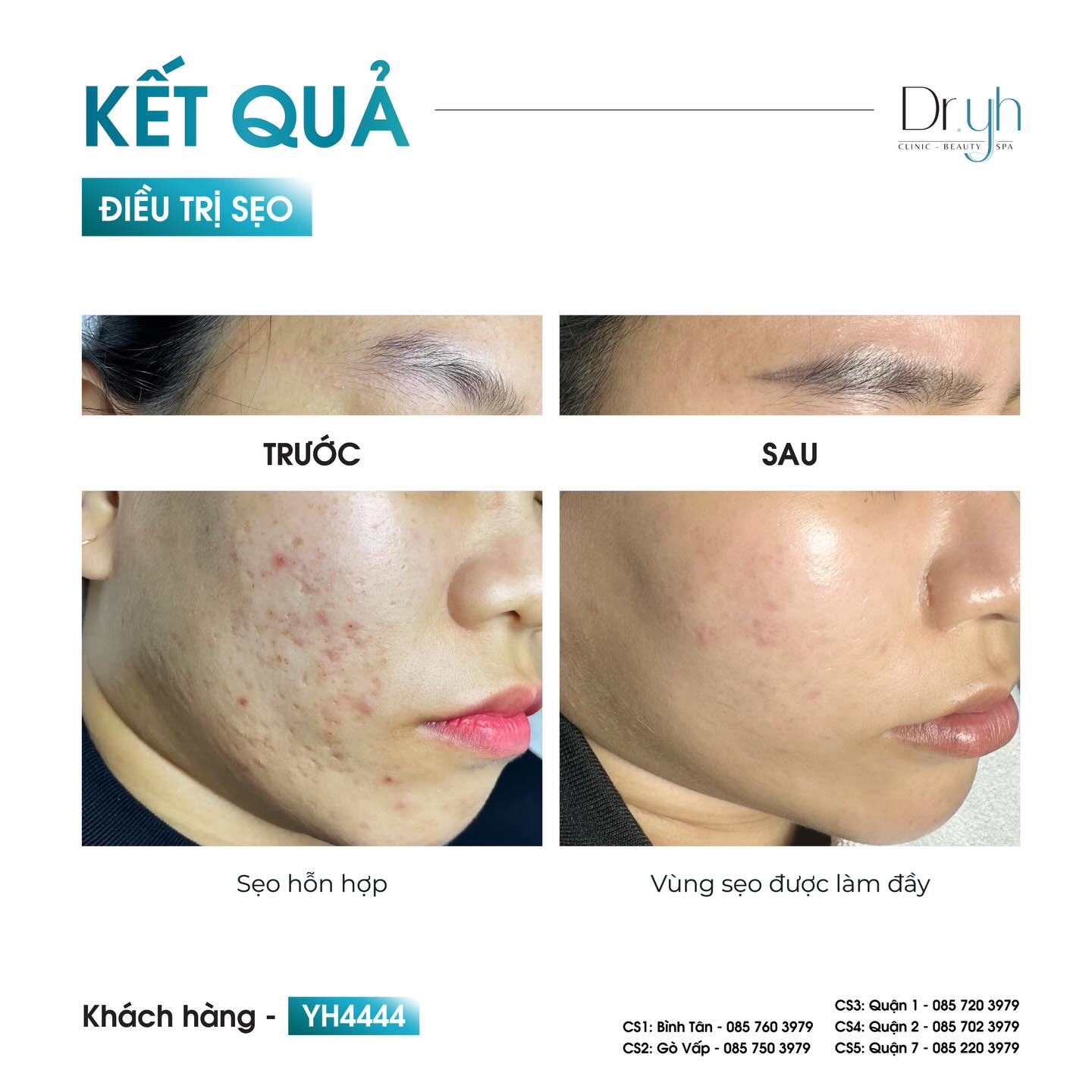 DR.YH Clinic & Spa Facebook ad: 𝐃𝐑.𝐘𝐇 𝐂𝐀𝐒𝐄 𝐋𝐈𝐁𝐑𝐀𝐑𝐘| Đ𝐈𝐄̂̀𝐔 𝐓𝐑𝐈̣…