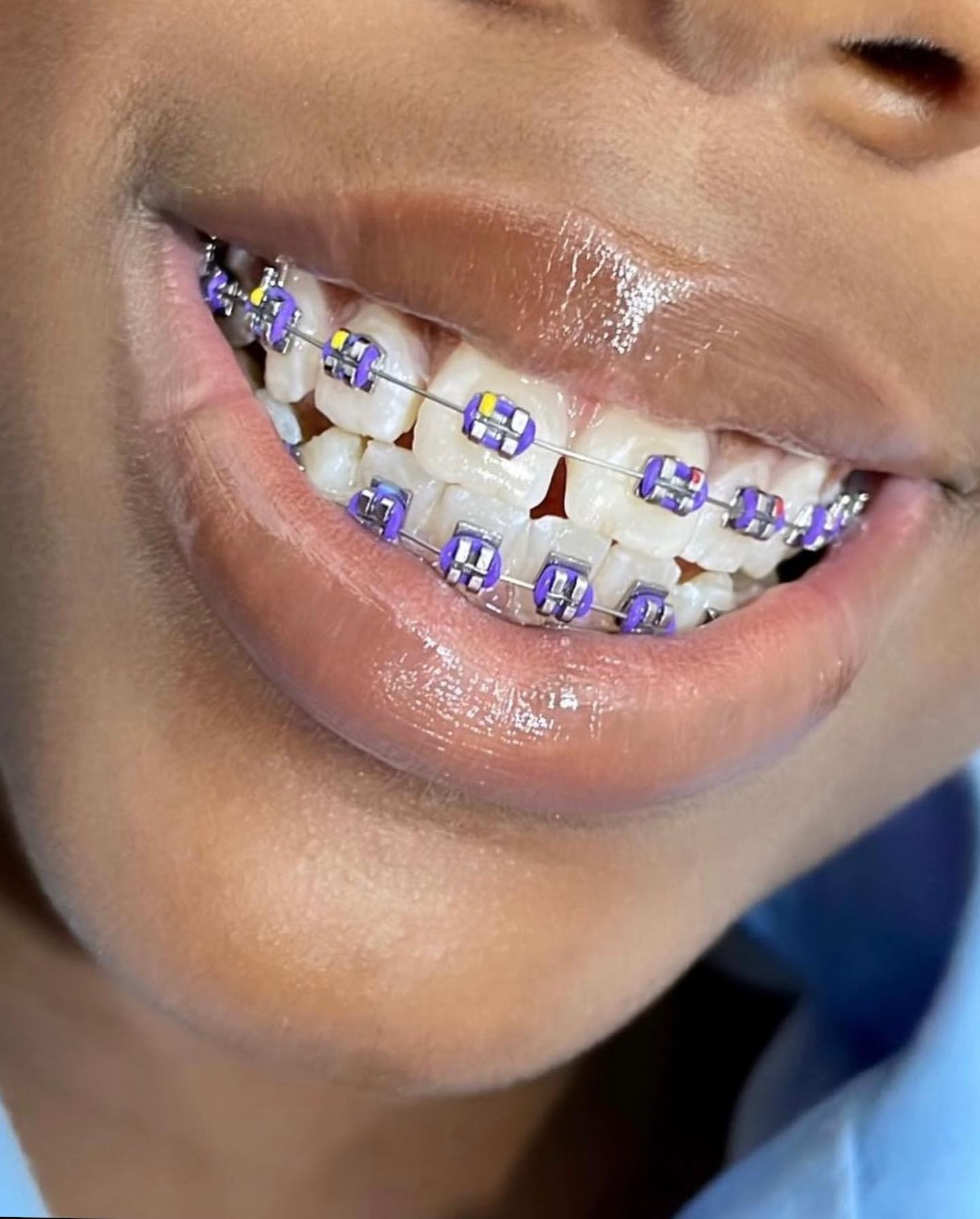 SMILE BEST Dental Clinic, Lagos Facebook ad