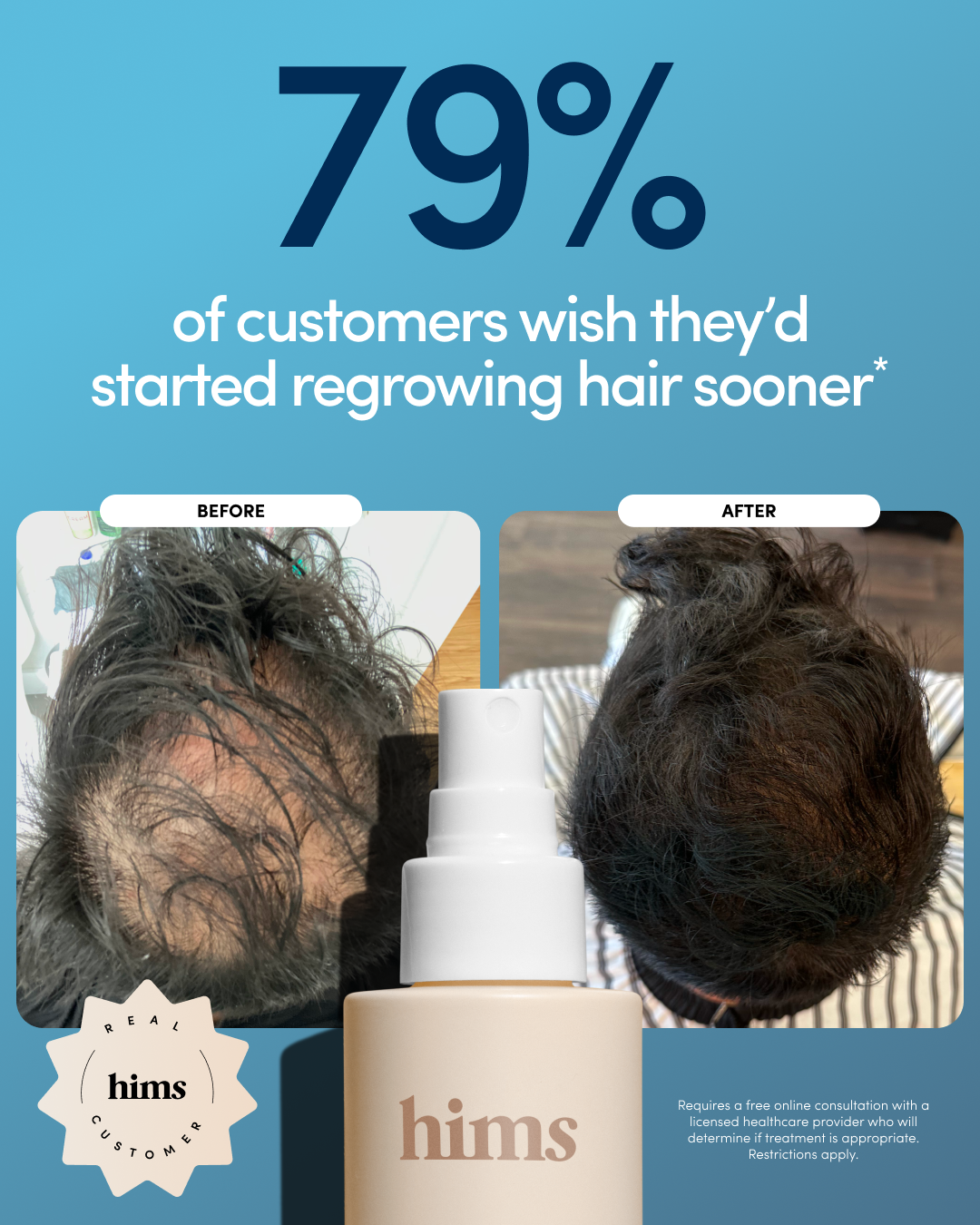 hims Facebook ad
