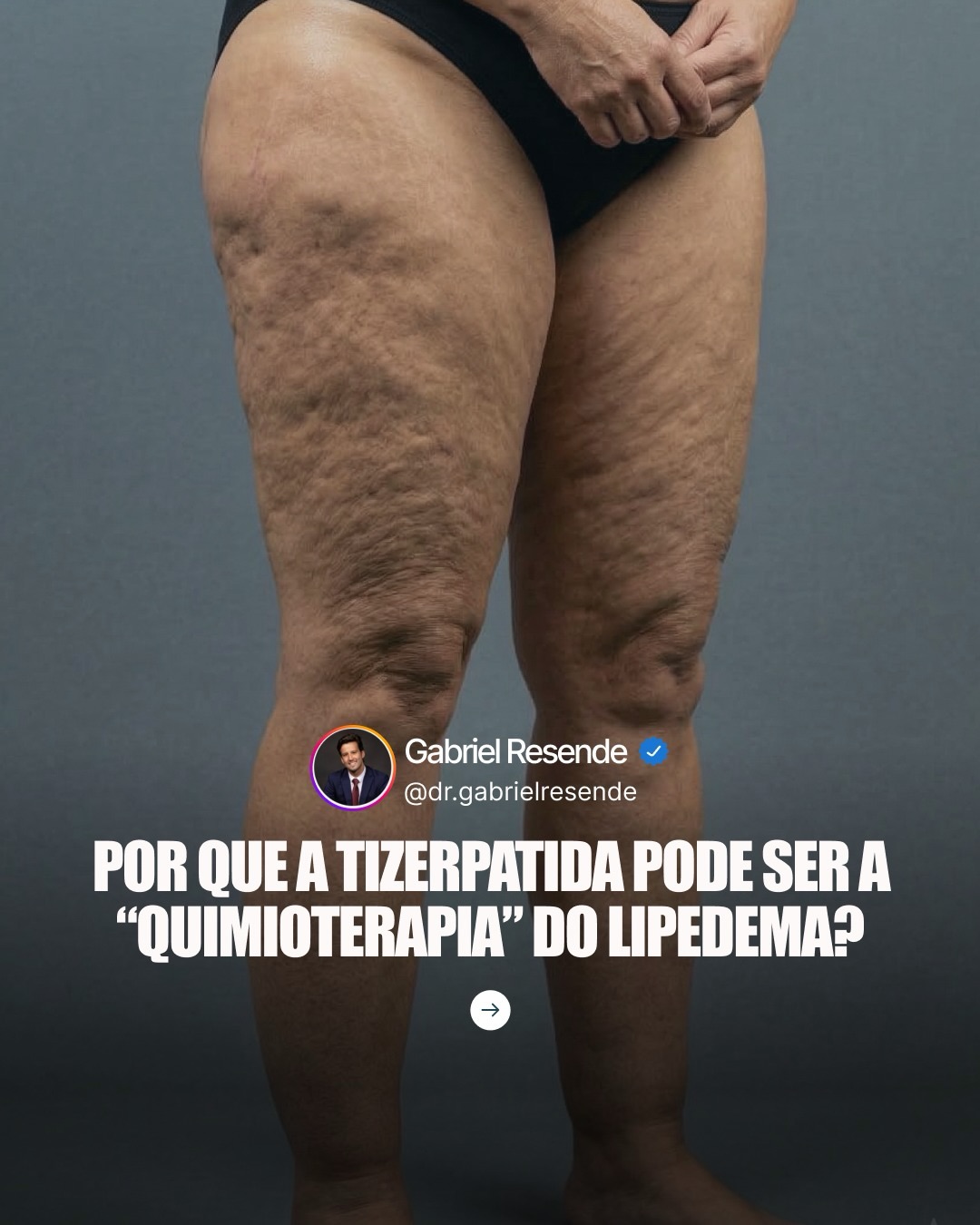 Dr. Gabriel Resende - Emagrecimento Facebook ad: Existe uma hipótese nova e provocativa surgindo no…