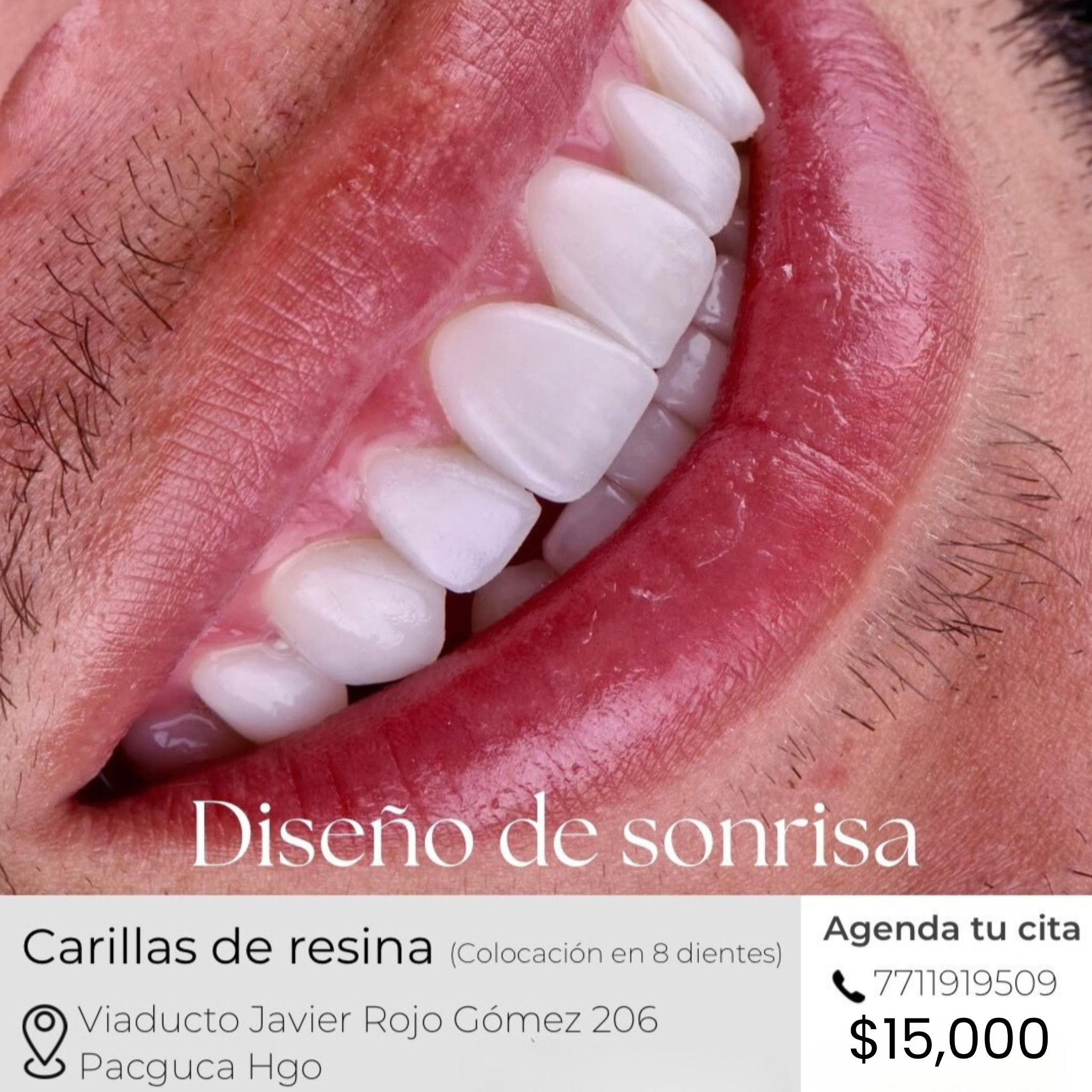 Dr José Antonio Gutierrez Facebook ad: Sonríe con confianza: transforma tu sonrisa hoy