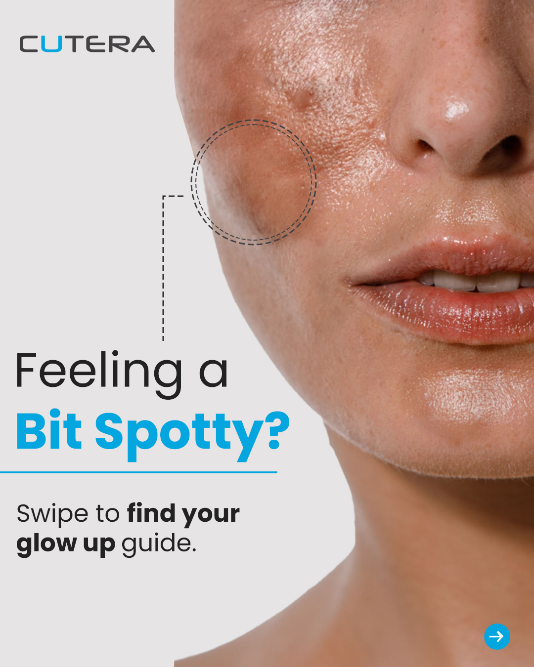 Cutera Aesthetics Facebook ad: Swipe through your ultimate glow-up guide-from fading dark…