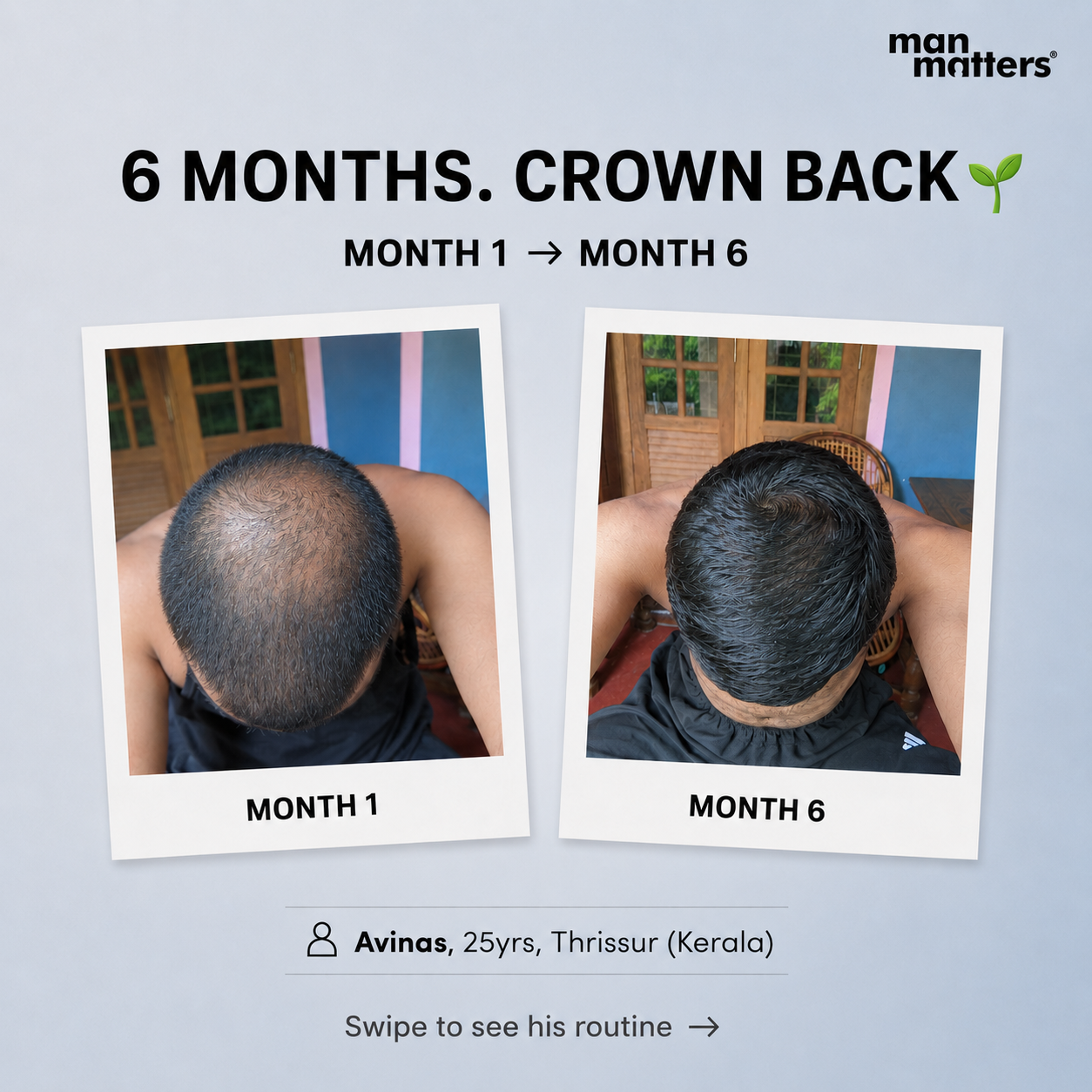 Hair Matters by Man Matters Facebook ad