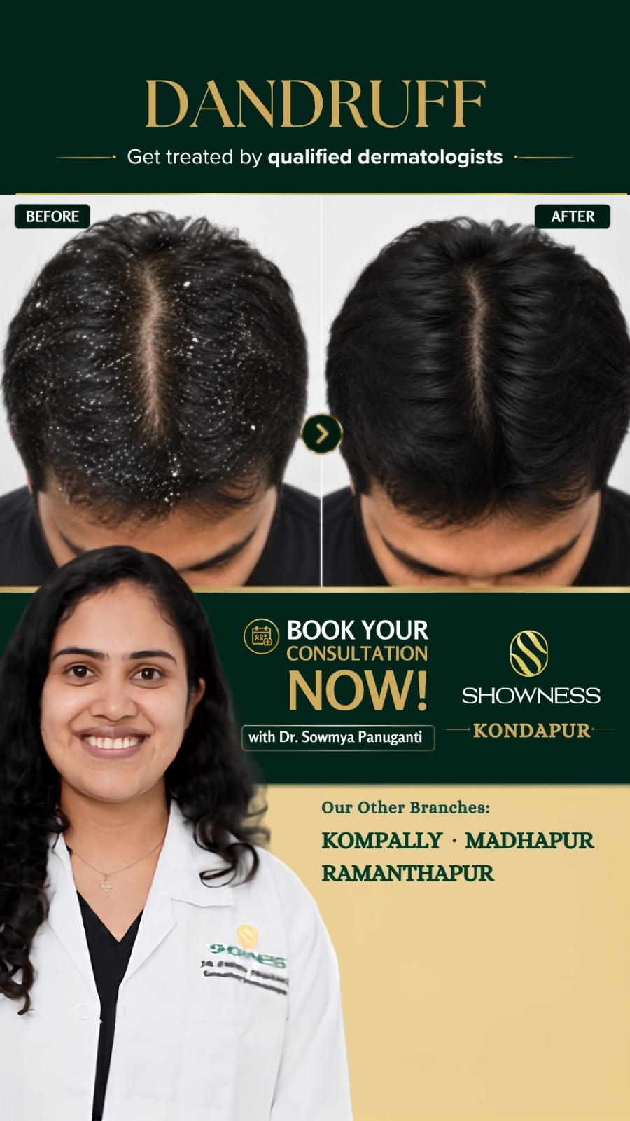 Showness Facebook ad