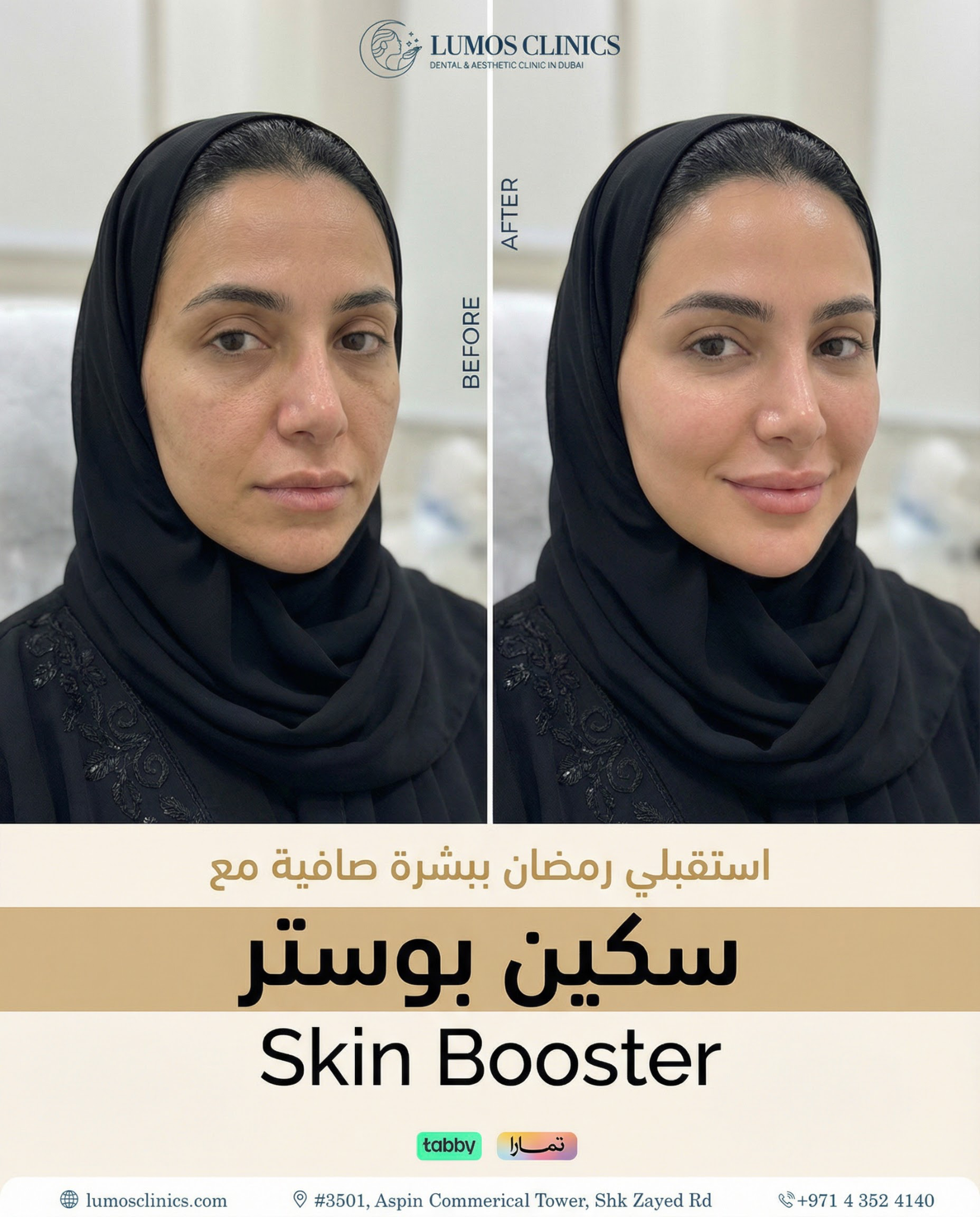 Lumos Dental & Aesthetic Clinic Facebook ad from Feb 20, 2026