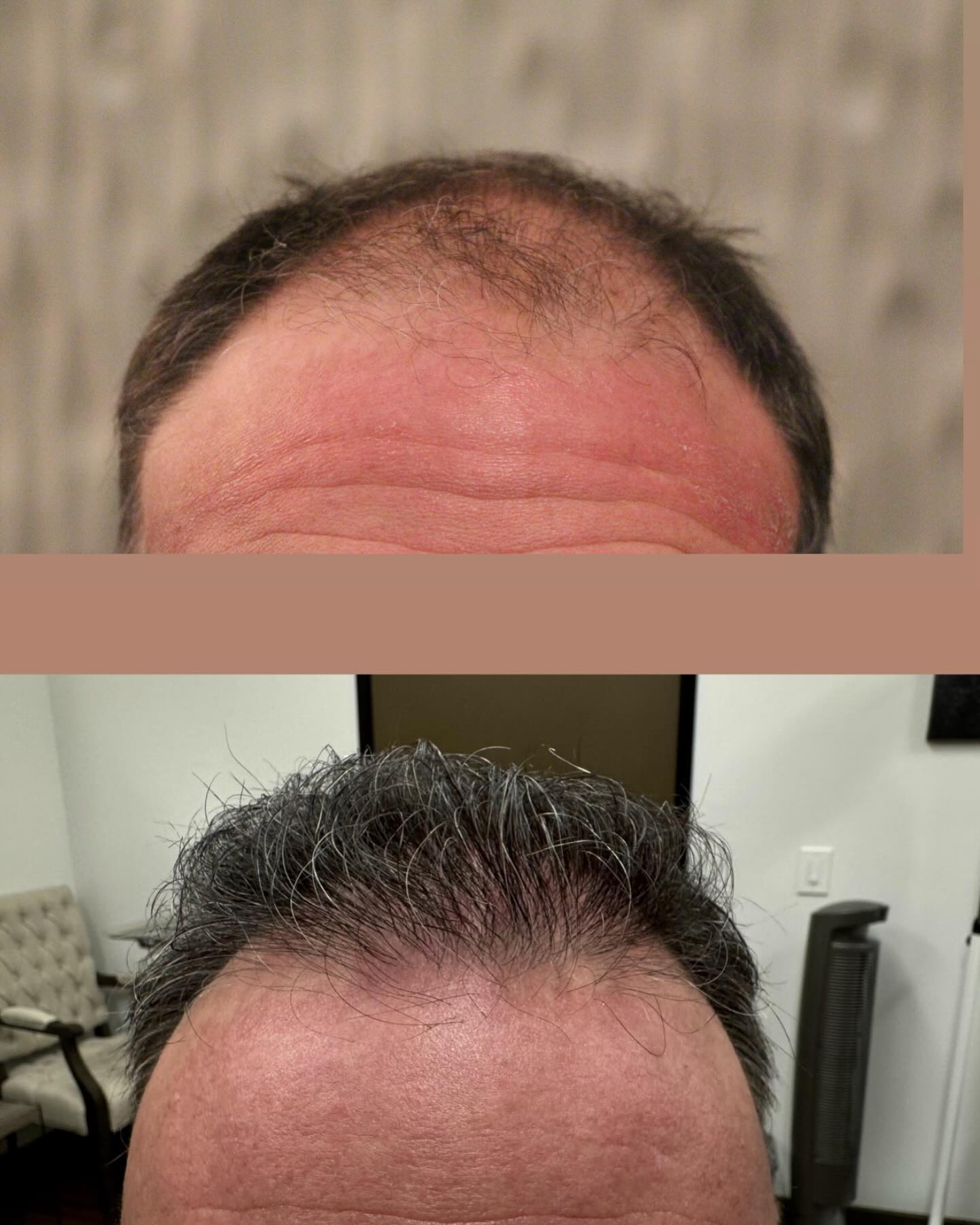 Modena Hair Institute Facebook ad