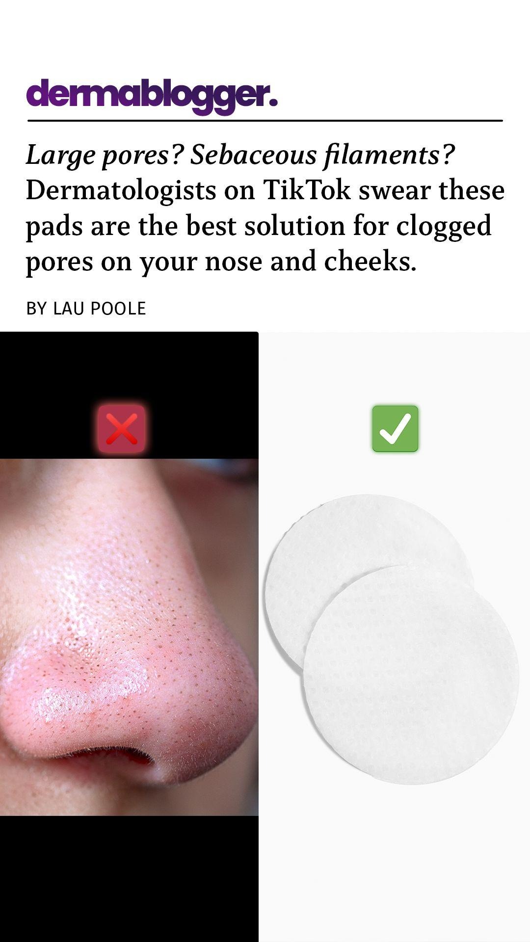 Derma Blogger Facebook ad from Mar 26, 2026