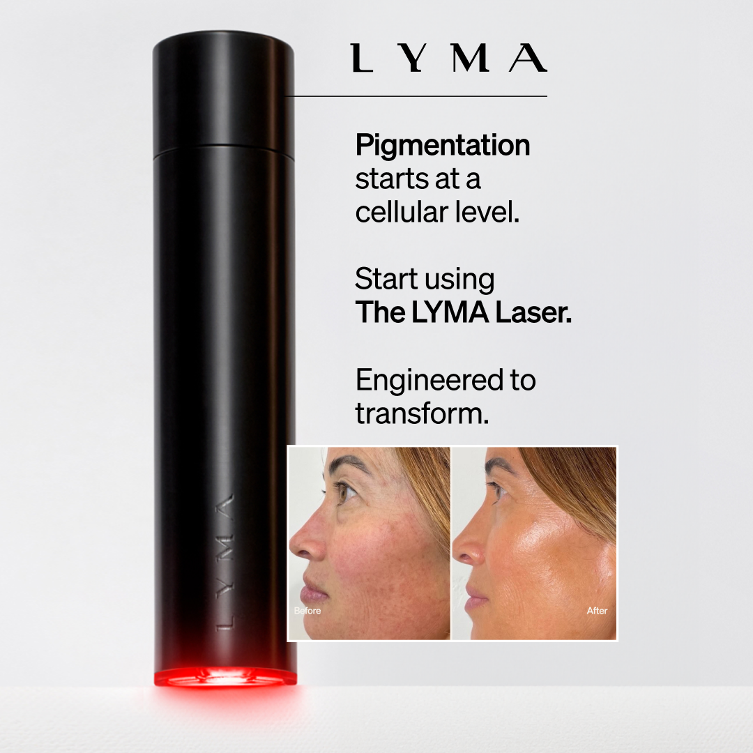 LYMA Facebook ad