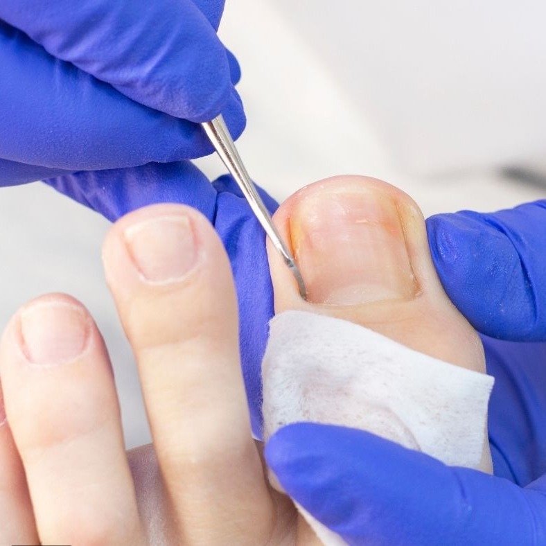 Step First Podiatry Facebook ad from Dec 9, 2025