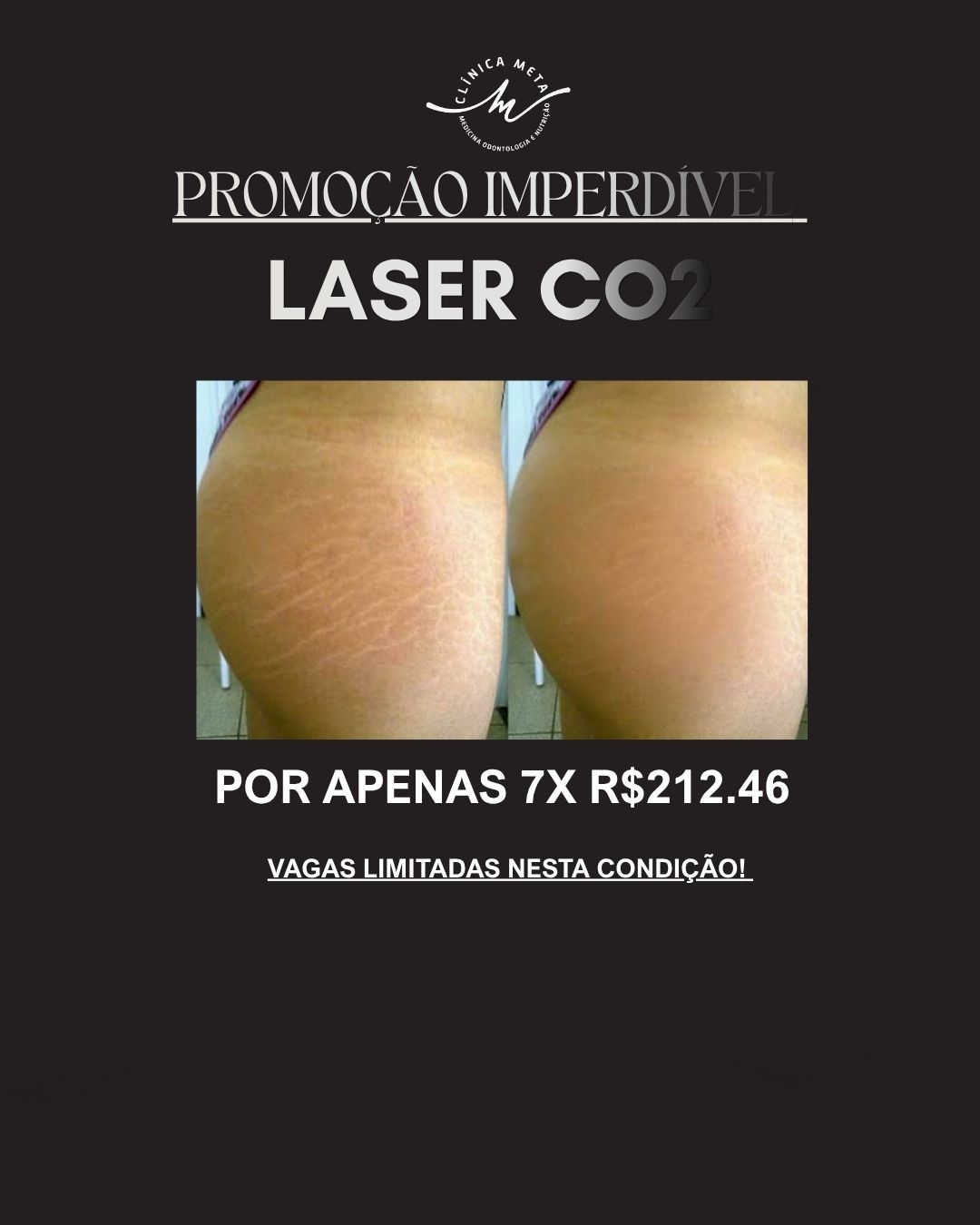 Clínica META - Medicina Integrativa e Estética Facebook ad from May 29, 2026