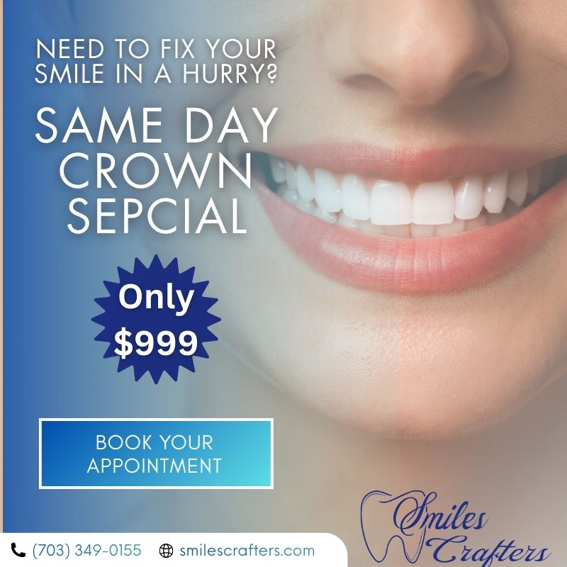 SmilesCrafters of Annandale Facebook ad: Dental Crowns Annandale