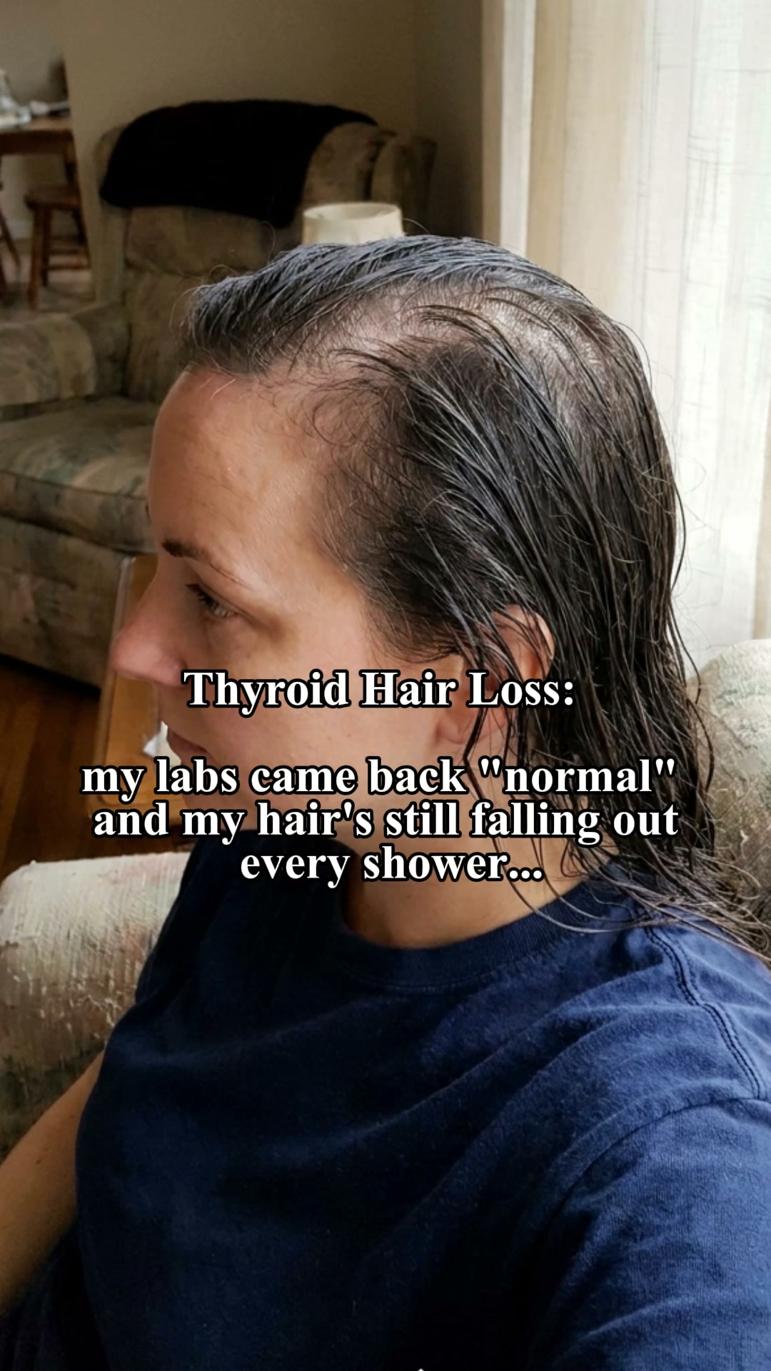 Bloom & Bond Facebook ad: Treating Your Thyroid Won't Bring Your Hair Back