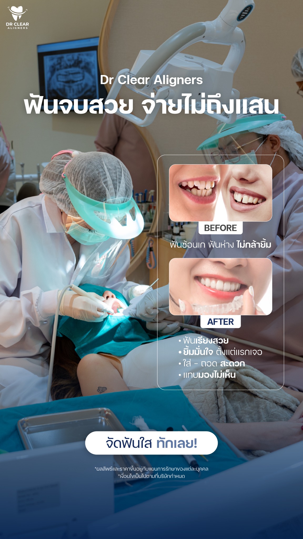 Dr Clear Aligners Thailand Facebook ad: จัดฟันใส Dr Clear Aligners