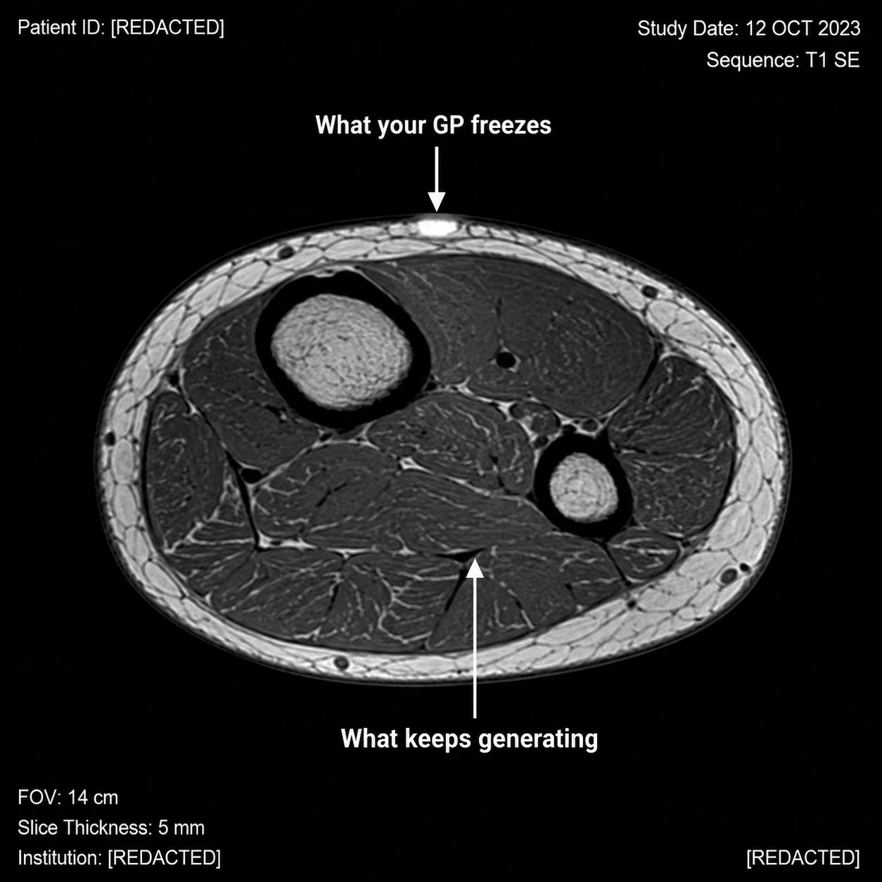 Actinic Keratosis Recovery Facebook ad: Your GP Treats the Arrow on Top. The One Below Is Why It…