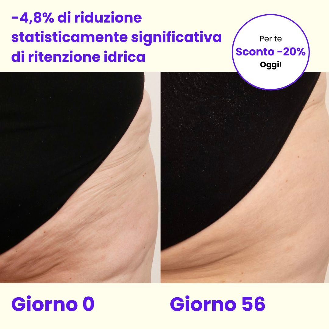 Iodase Cosmetics Facebook ad: Bye bye cellulite!