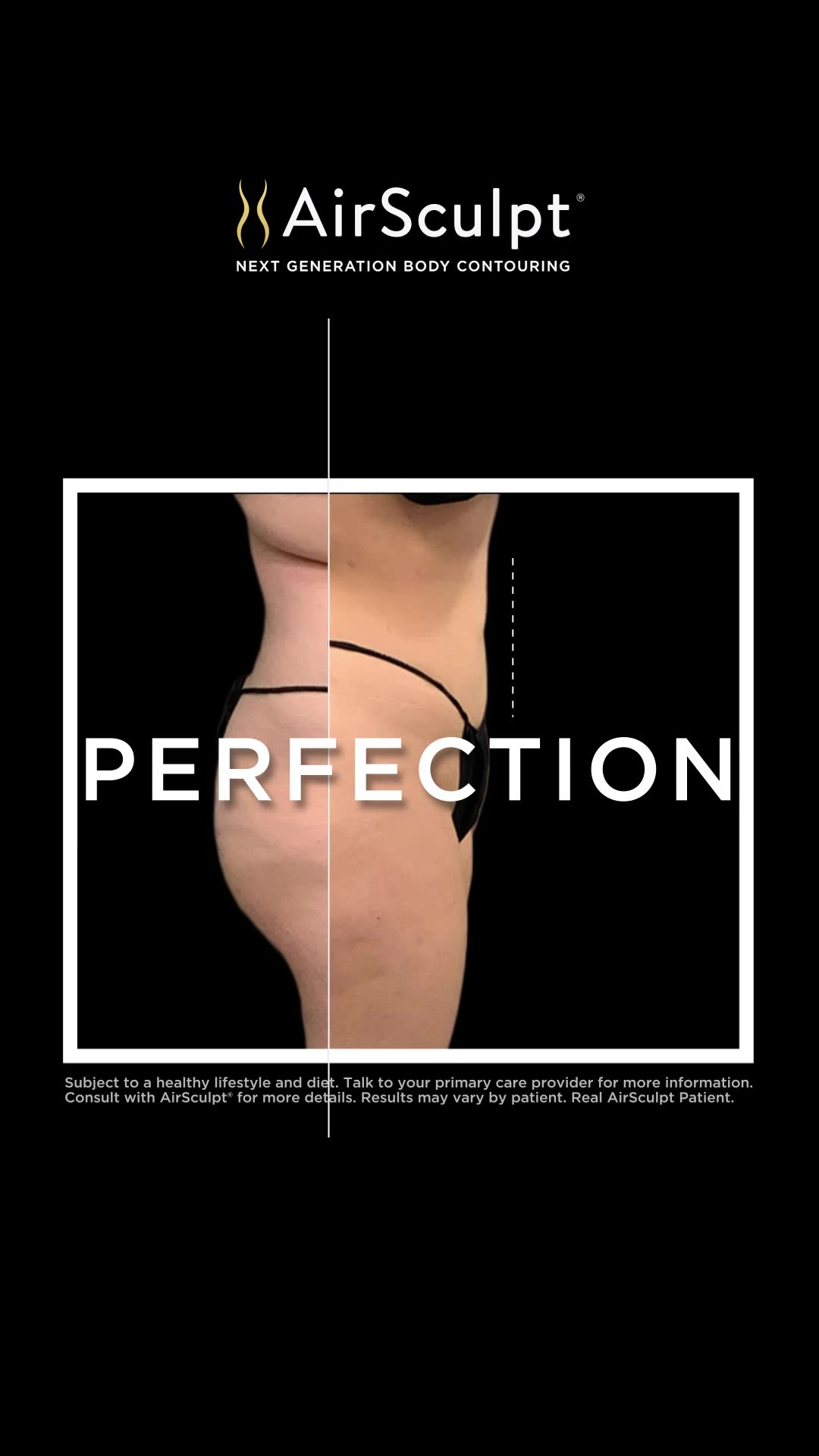 AirSculpt Facebook ad: Regain Your Confidence