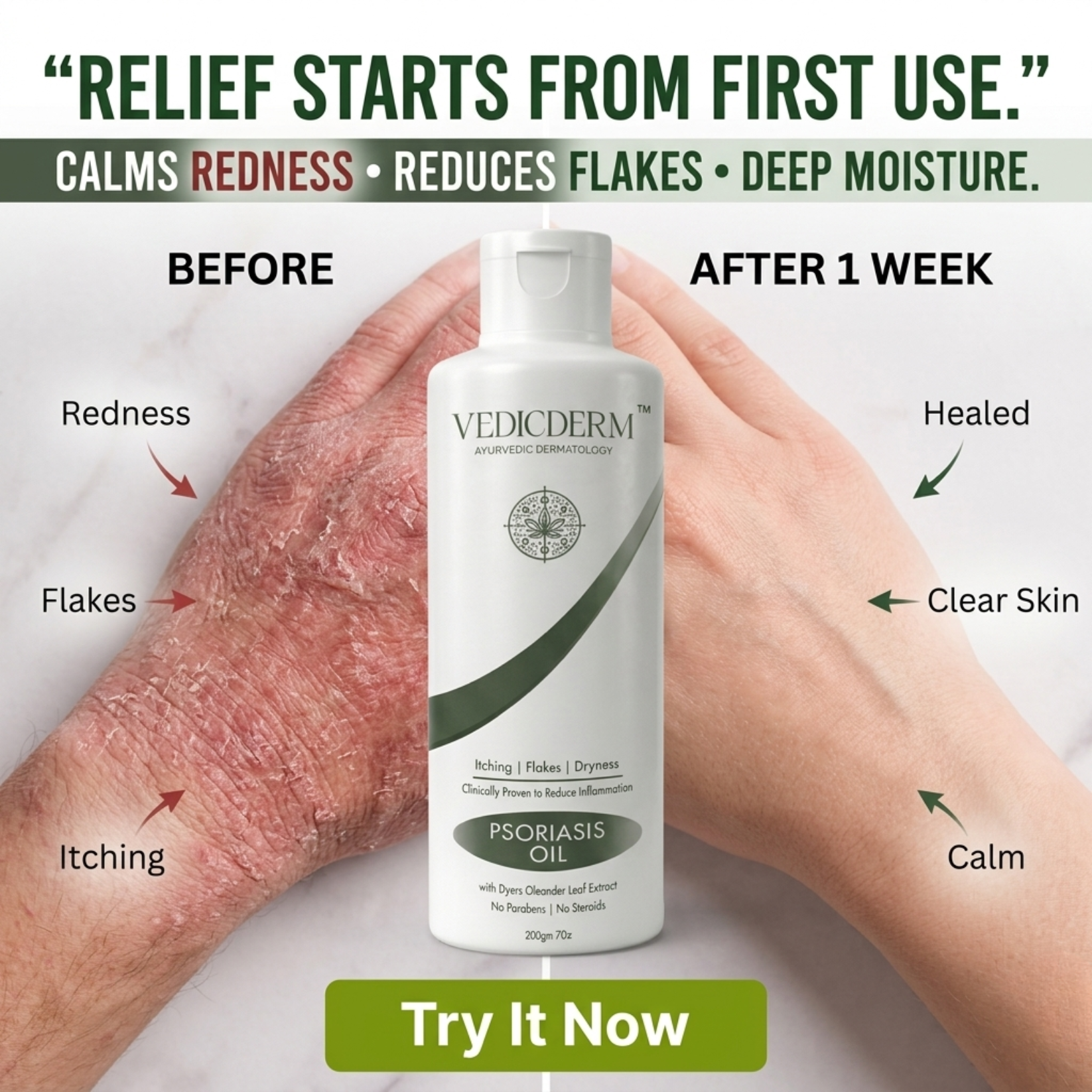 VedicDerm Facebook ad