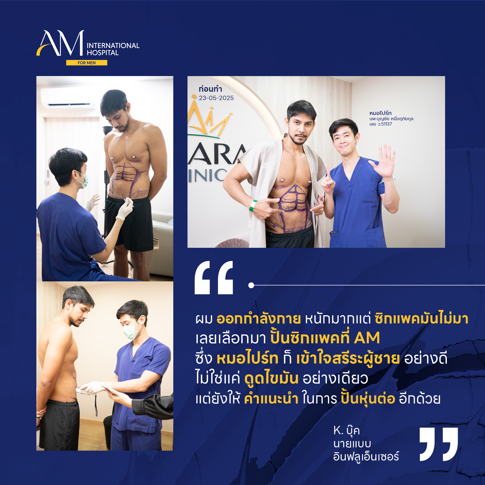 AM Liposuction for Men Facebook ad