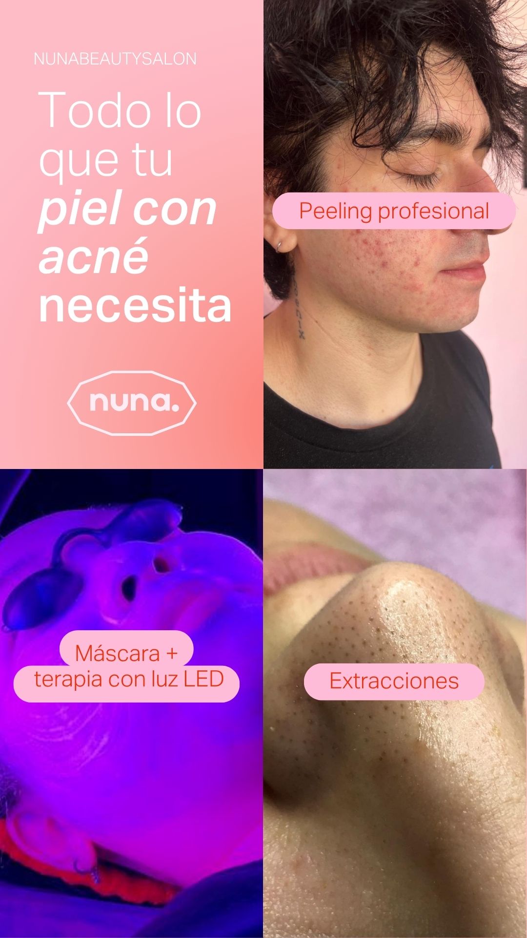 Korean Makeup Buenos Aires Facebook ad: ¿PIEL CON ACNÉ?