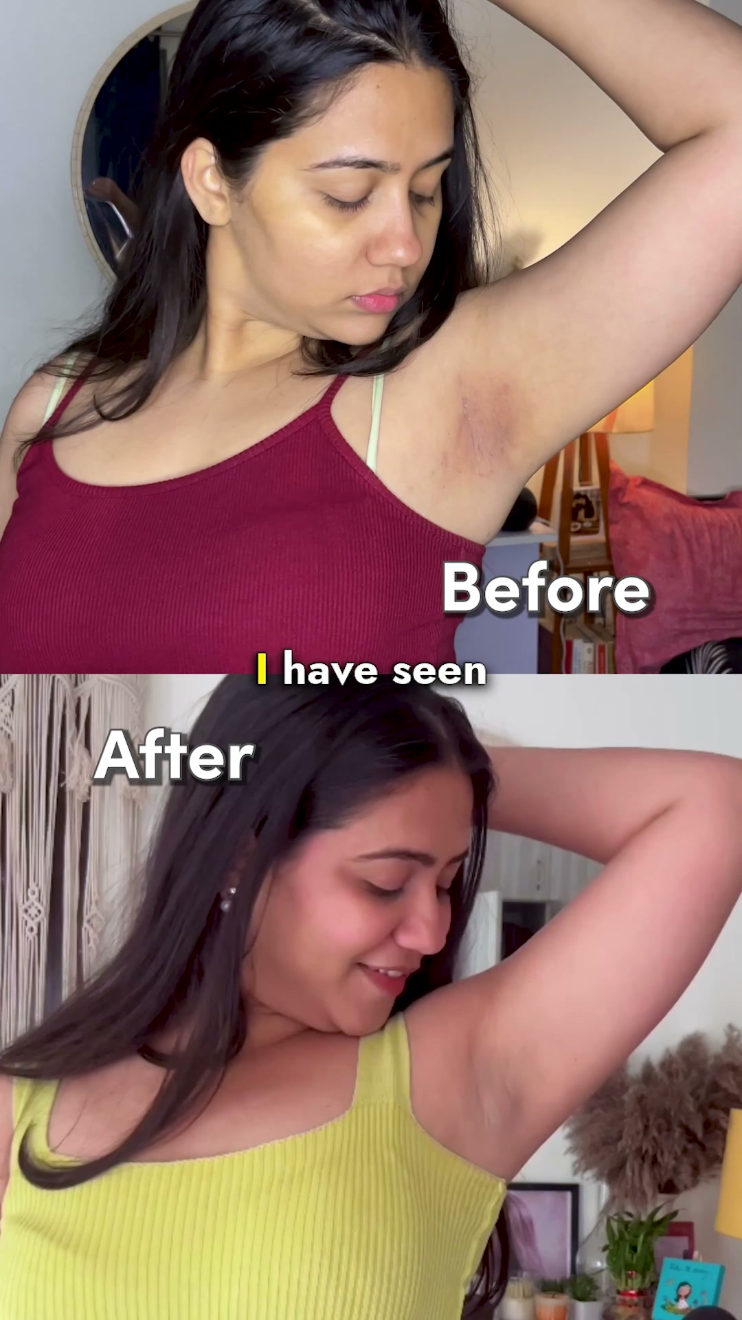 Be Bodywise - UAE Facebook ad: Do you have severe underarm pigmentation?