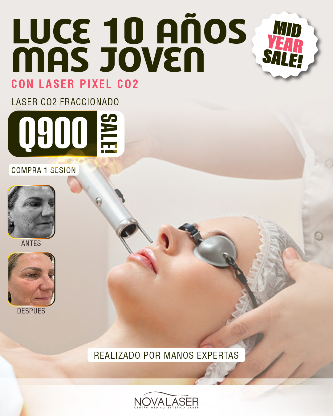 Novalaser GT Facebook ad