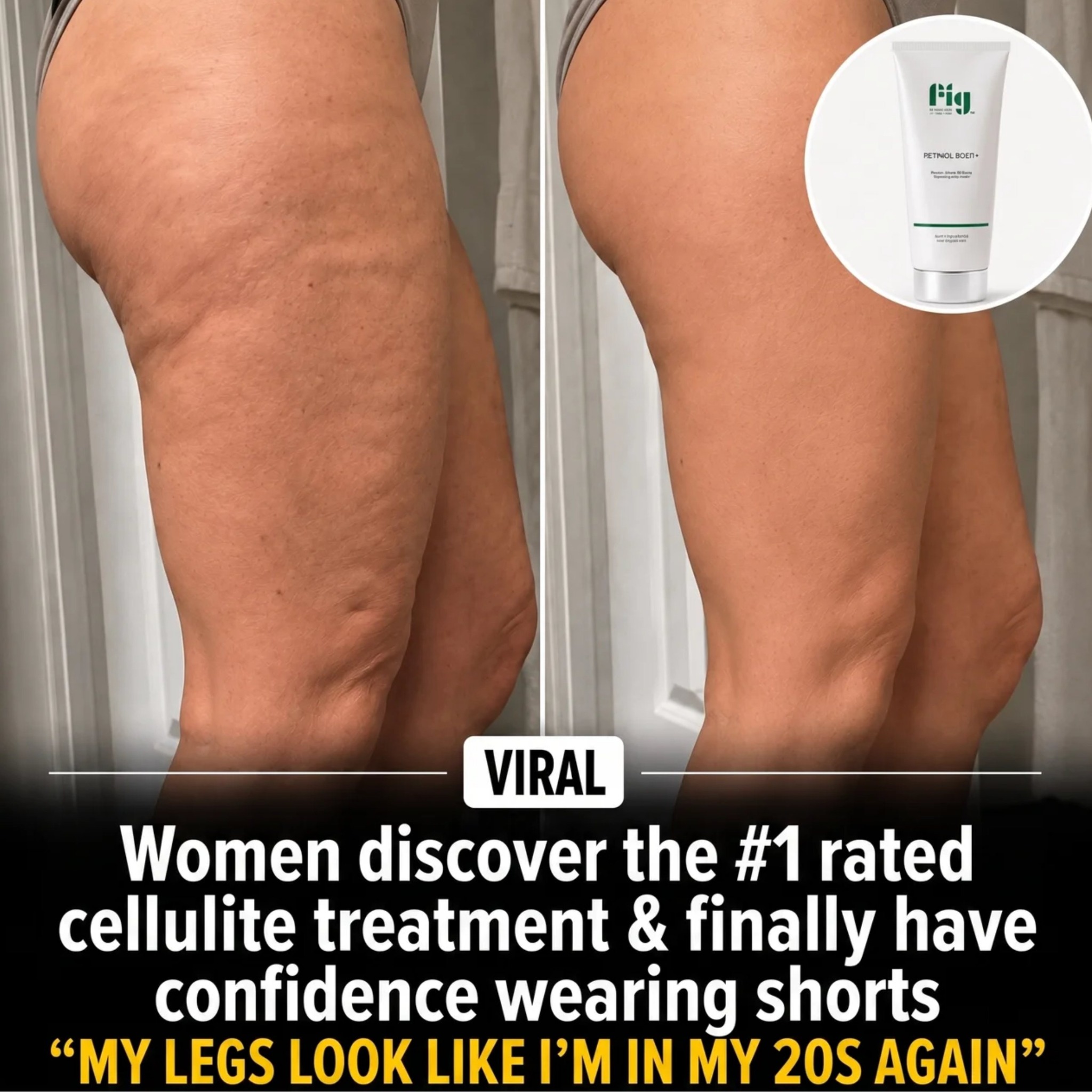 FigMD Skincare Facebook ad: Your Cellulite Isn't Getting Worse. Your Skin Is.