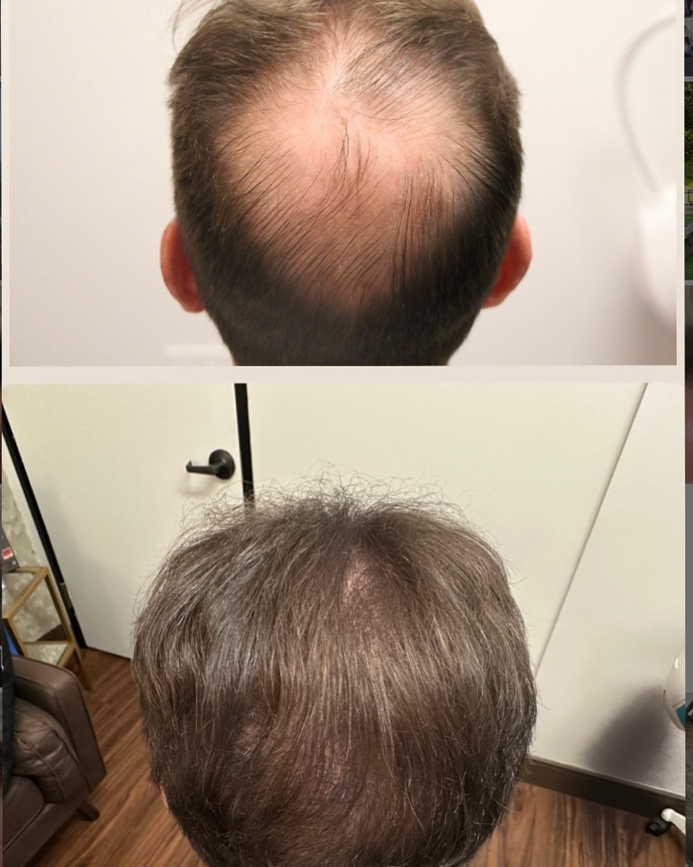 Modena Hair Institute Facebook ad