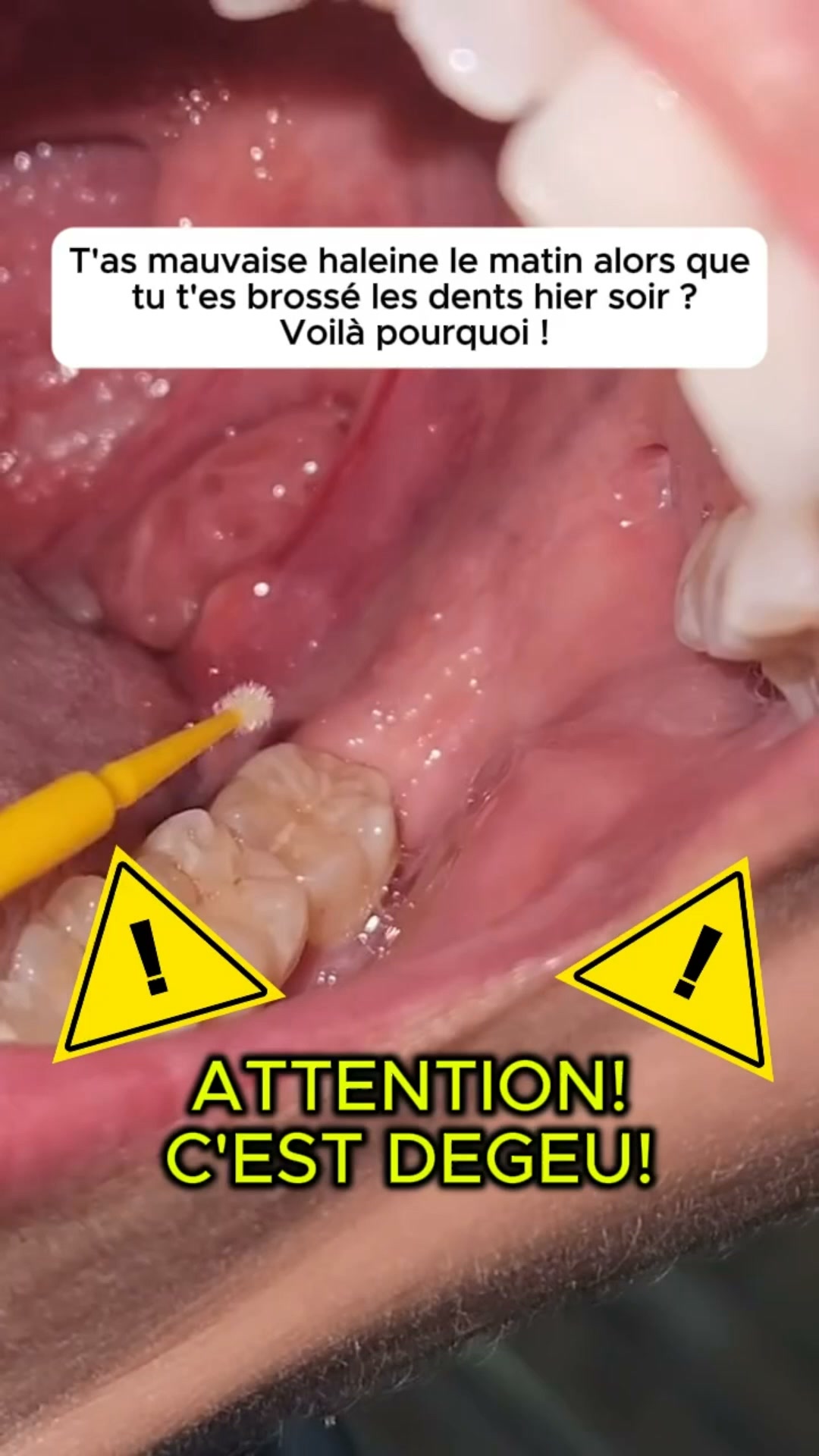 Medoria Facebook ad: Livraison Gratuite + Paiement à la Livraison partout au…