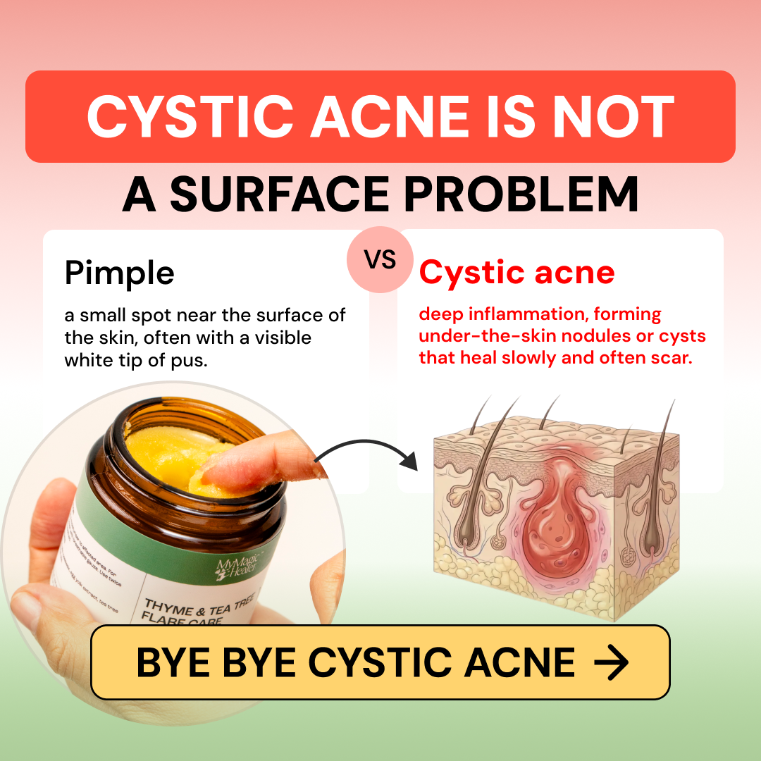 Mymagichealer Facebook ad: If it hurts to sit, stand, or walk… is that really ‘normal’?