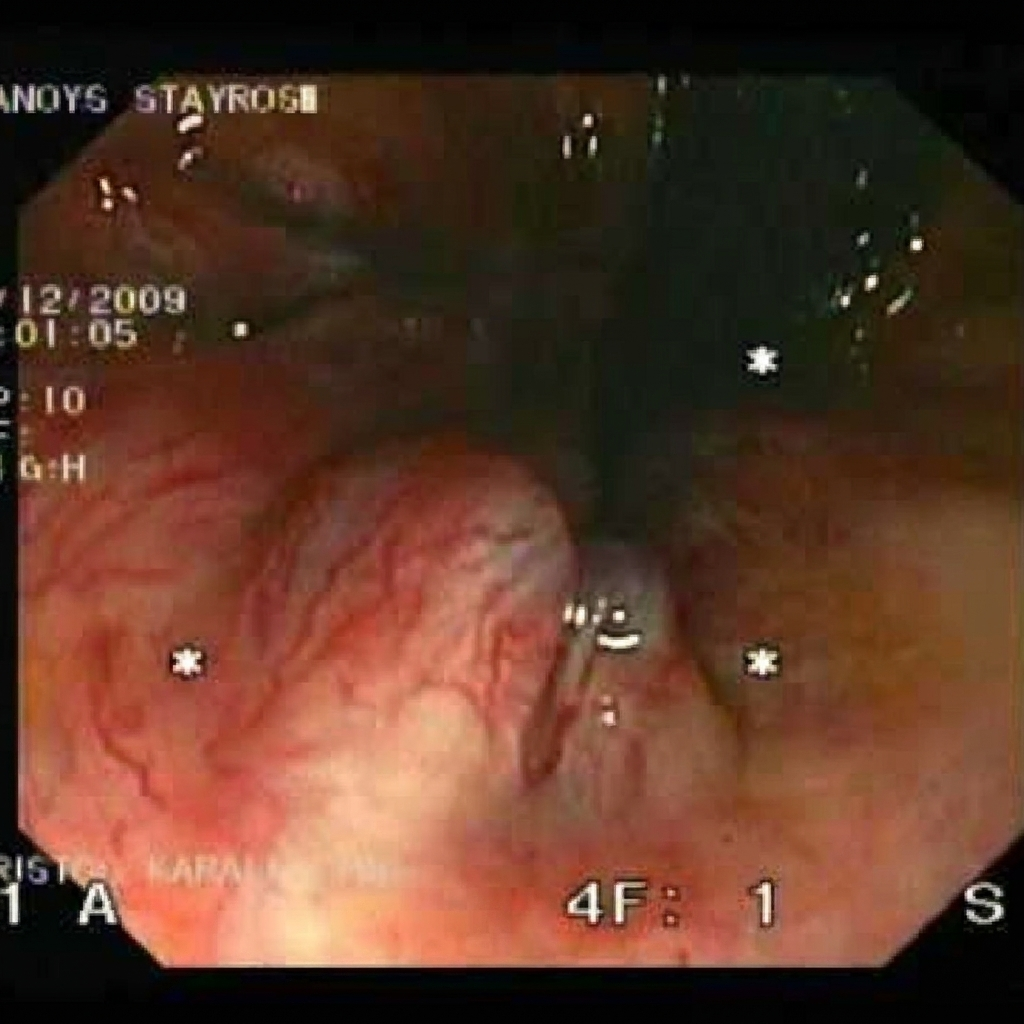 Skin Support and Recovery Group Facebook ad: If You Have A Chronic Hemorrhoid Itch, You'll Want To Read…