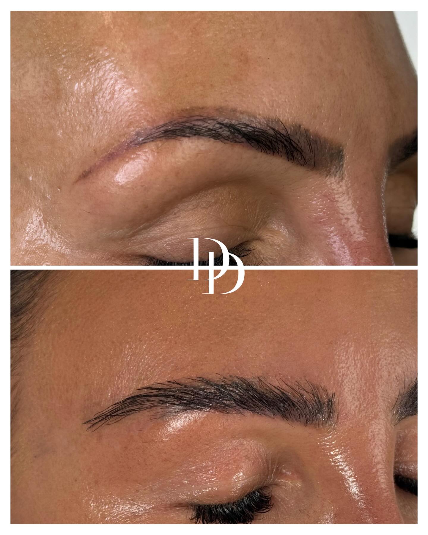 Dr. Ducu Facebook ad: Eyebrow Transplant, Ask About Our August Offer.