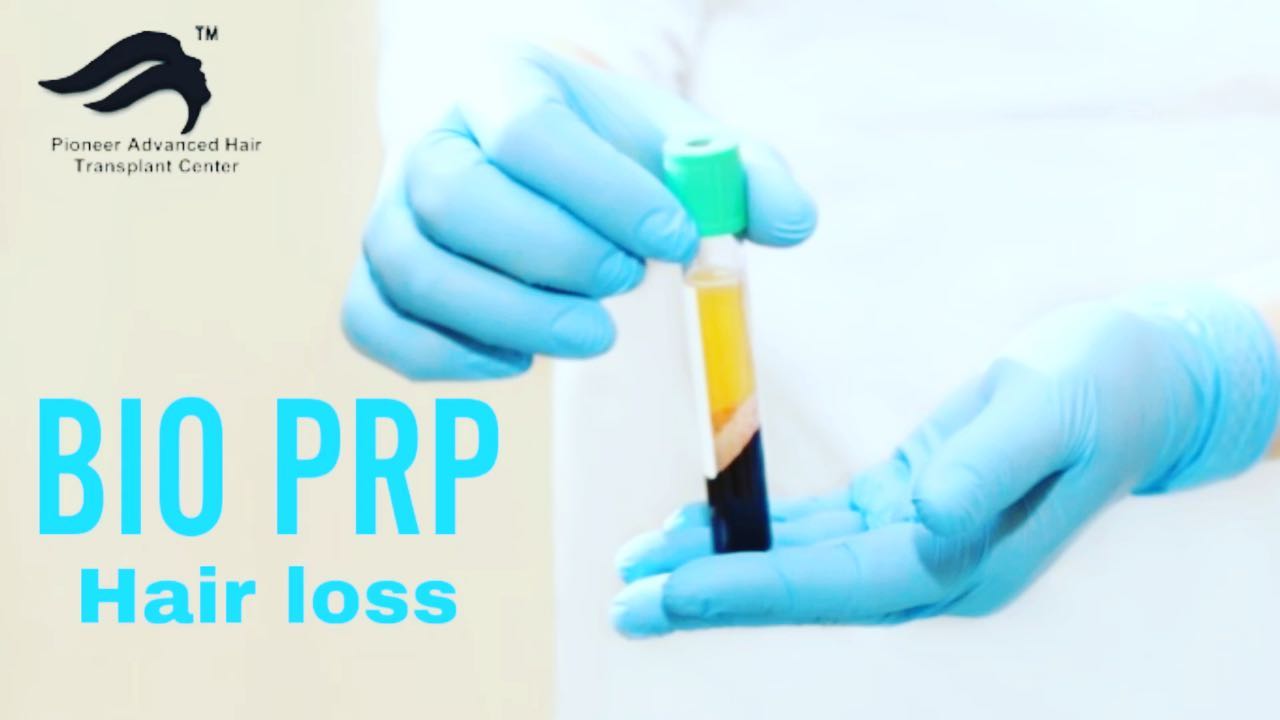 Pioneer Advanced Hair Transplant Center Facebook ad: Bio PRP for hair fall & hair thinning…