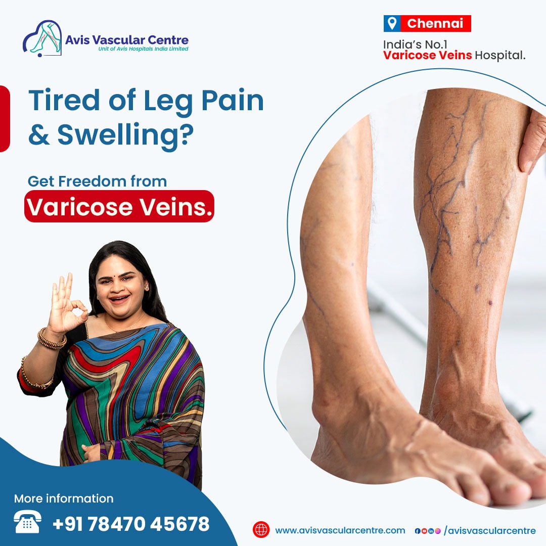 Avis Vascular Centre Facebook ad from Oct 21, 2025