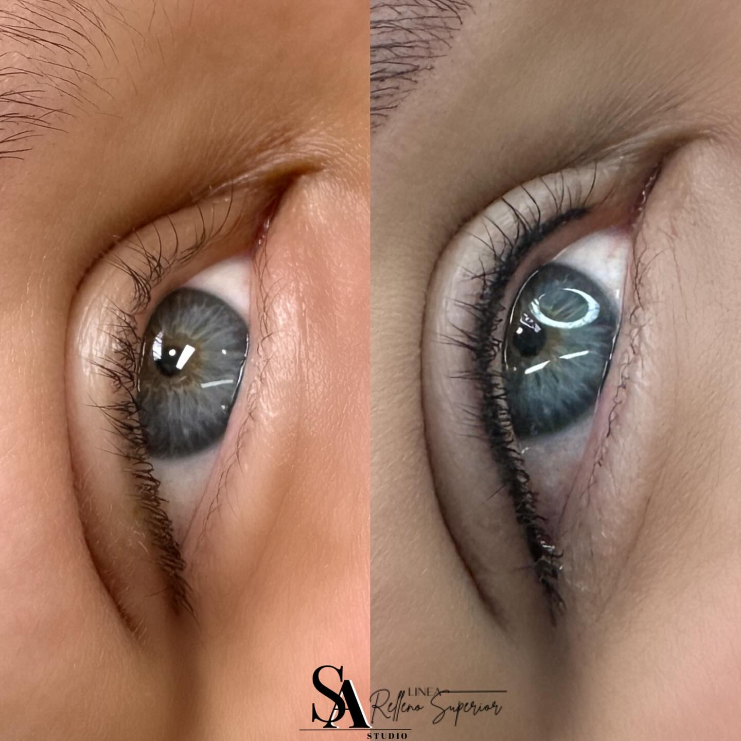 Saestheticspa Facebook ad: LÍNEA DE RELLENO SUPERIOR