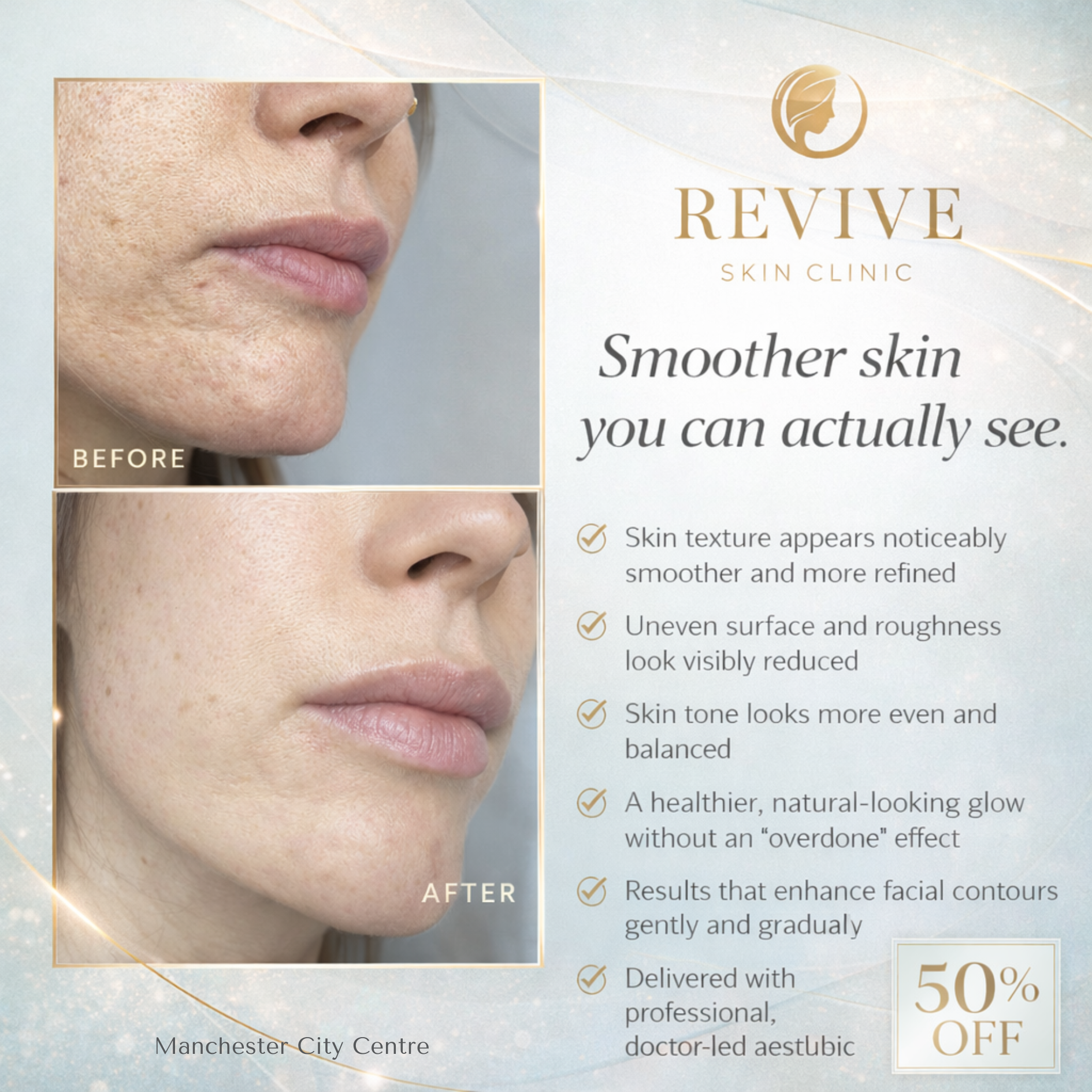 Revive - Skin Clinic Facebook ad: 50% Off CO2 Laser at Revive! Bye wrinkles & scars!